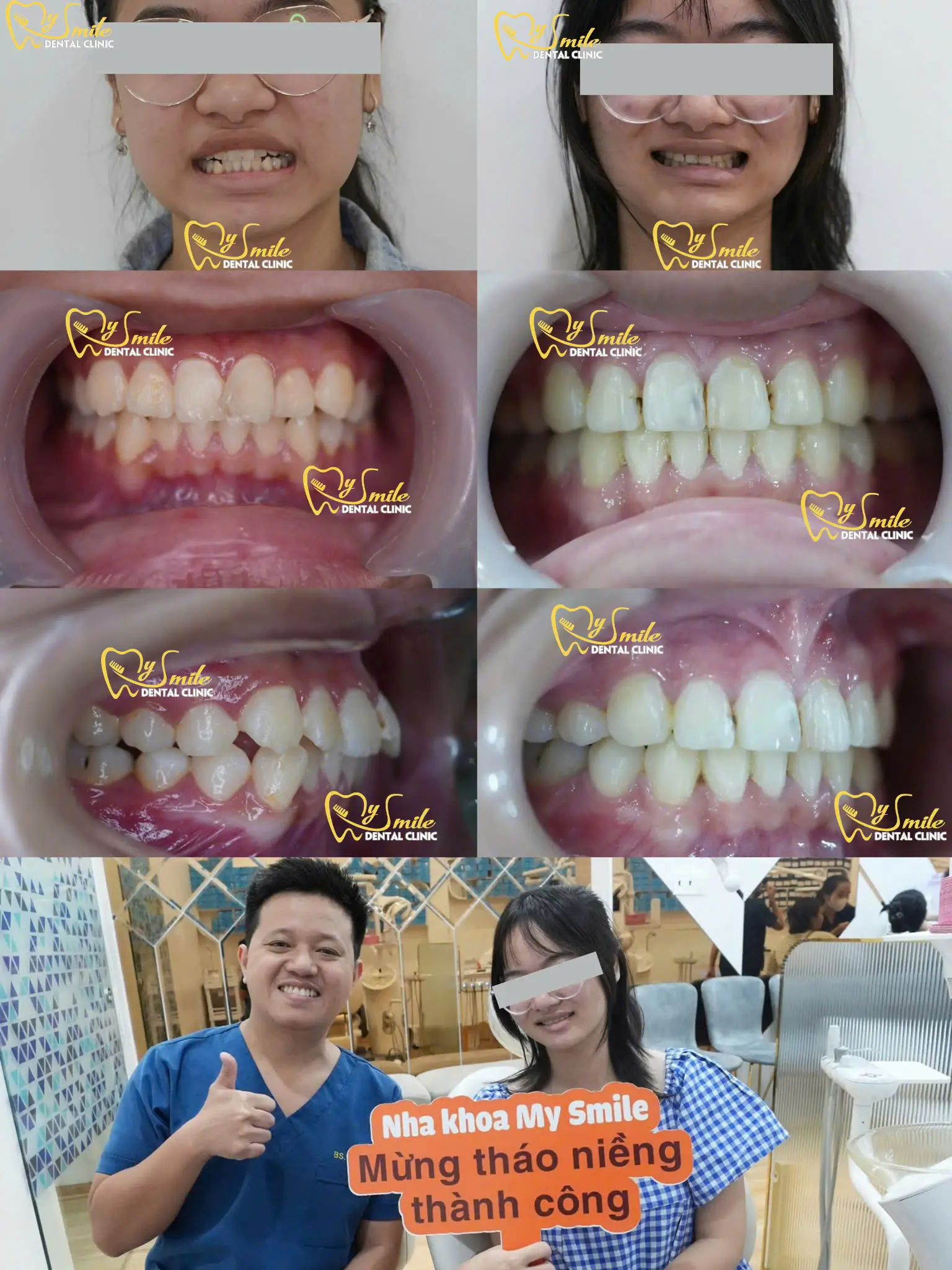 Niềng Răng Ở Đâu Tốt Tại Đà Nẵng? Top 5 Nha Khoa Được Khách Hàng Đánh Giá Cao