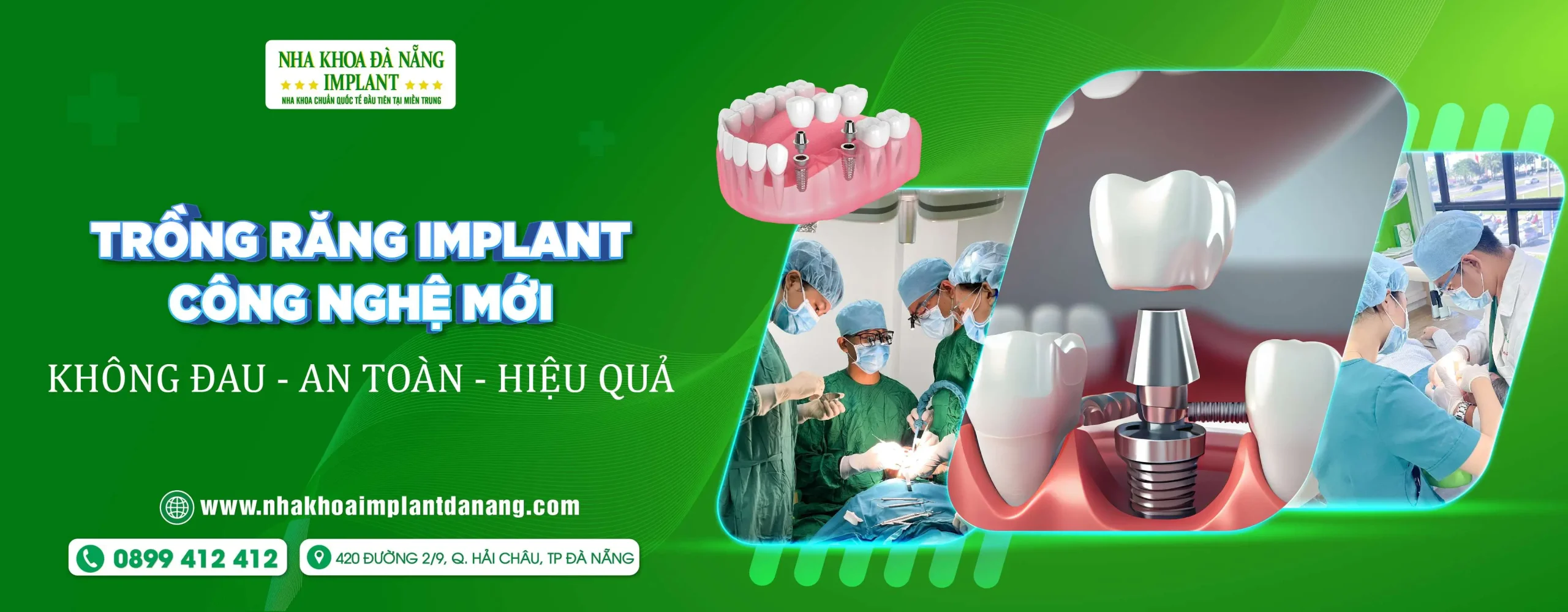 Top 5 Nha Khoa Trồng Implant Uy Tín Tại Đà Nẵng (Cập nhật 2025)