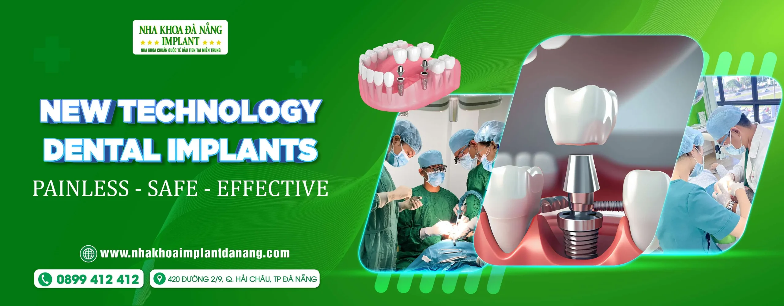 Top 5 Reputable Dental Implant Clinics in Da Nang (Updated 2025)