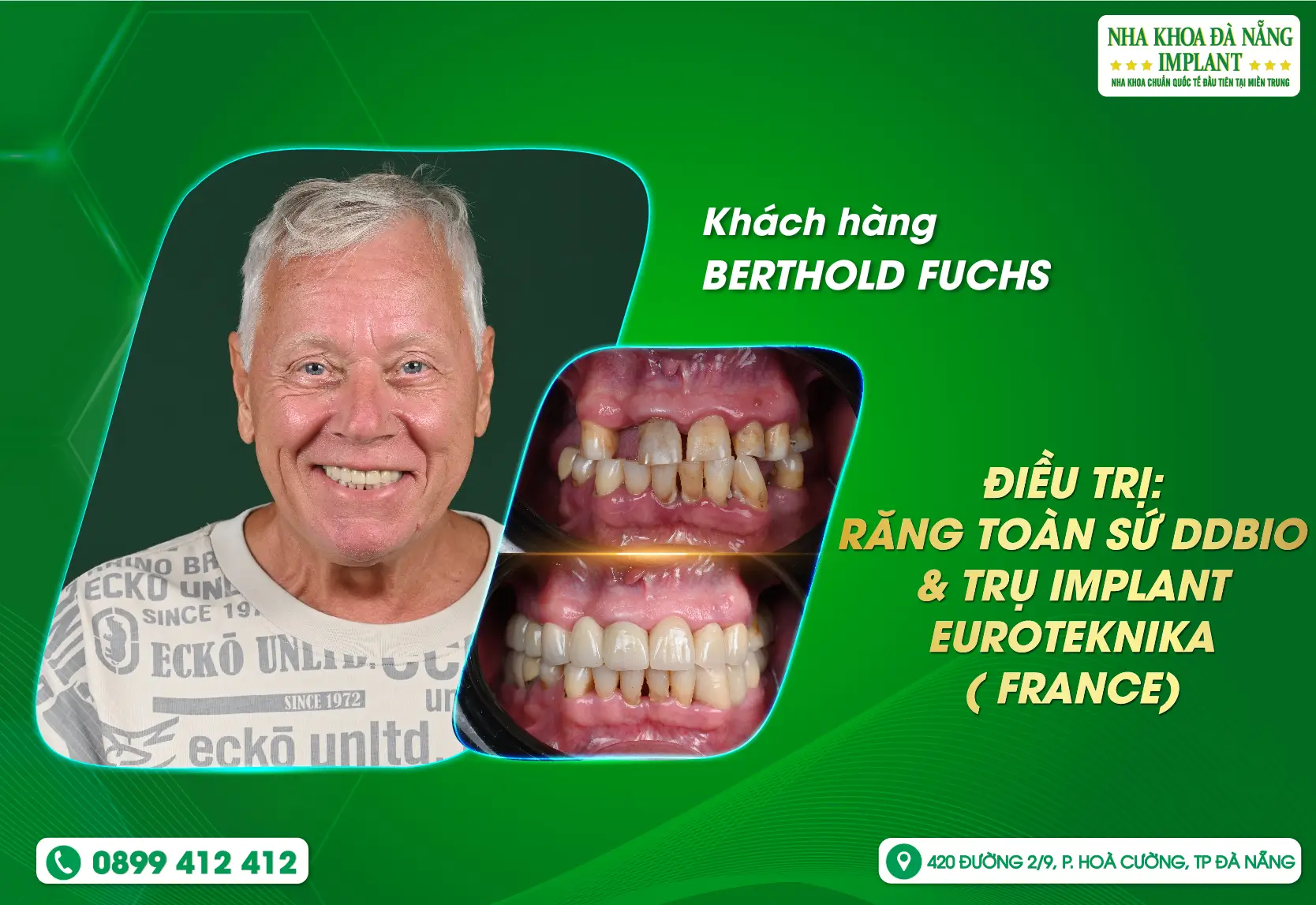 Từ Đức đến Việt Nam - Tìm lại nụ cười chuẩn chỉnh