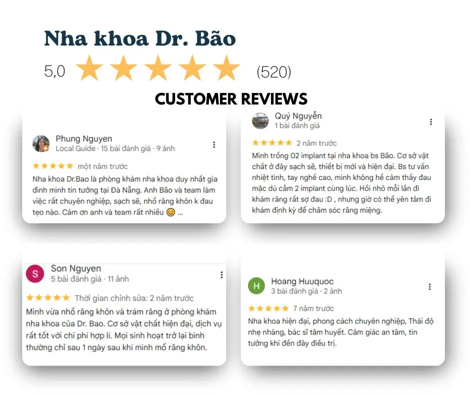 Top 5 Nha Khoa Trồng Implant Uy Tín Tại Đà Nẵng (Cập nhật 2025)