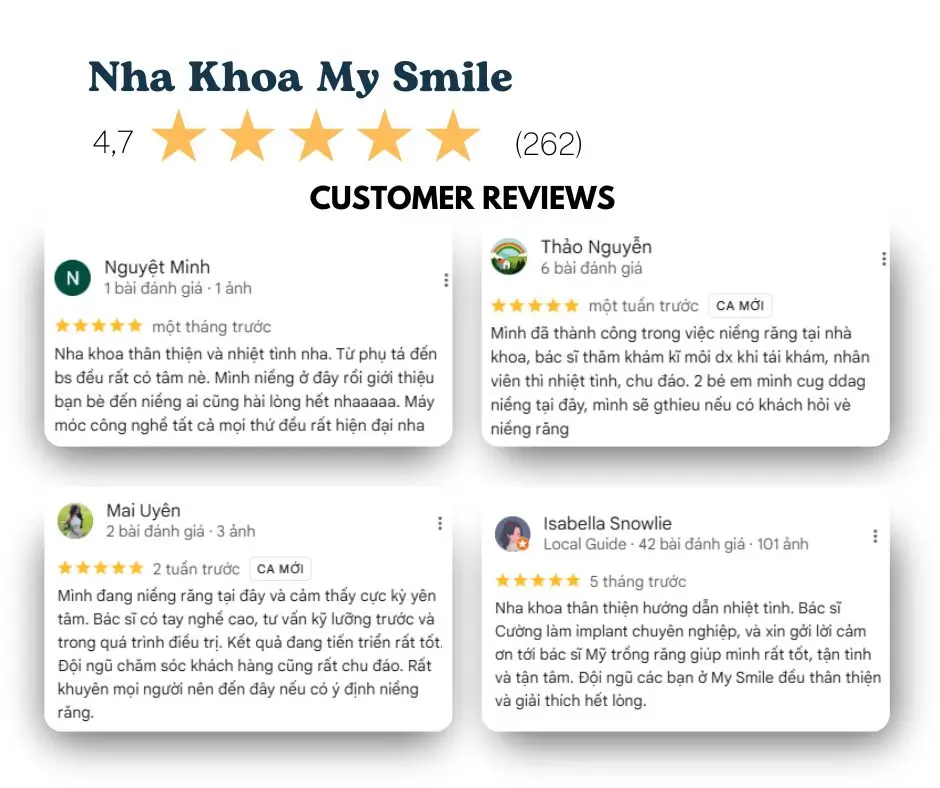 Top 5 Nha Khoa Trồng Implant Uy Tín Tại Đà Nẵng (Cập nhật 2025)