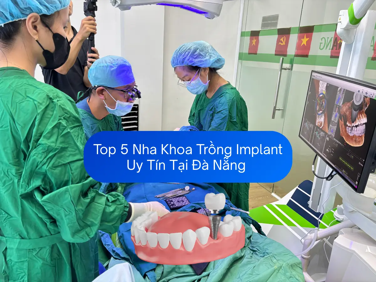 Top 5 Nha Khoa Trồng Implant Uy Tín Tại Đà Nẵng (Cập nhật 2025)