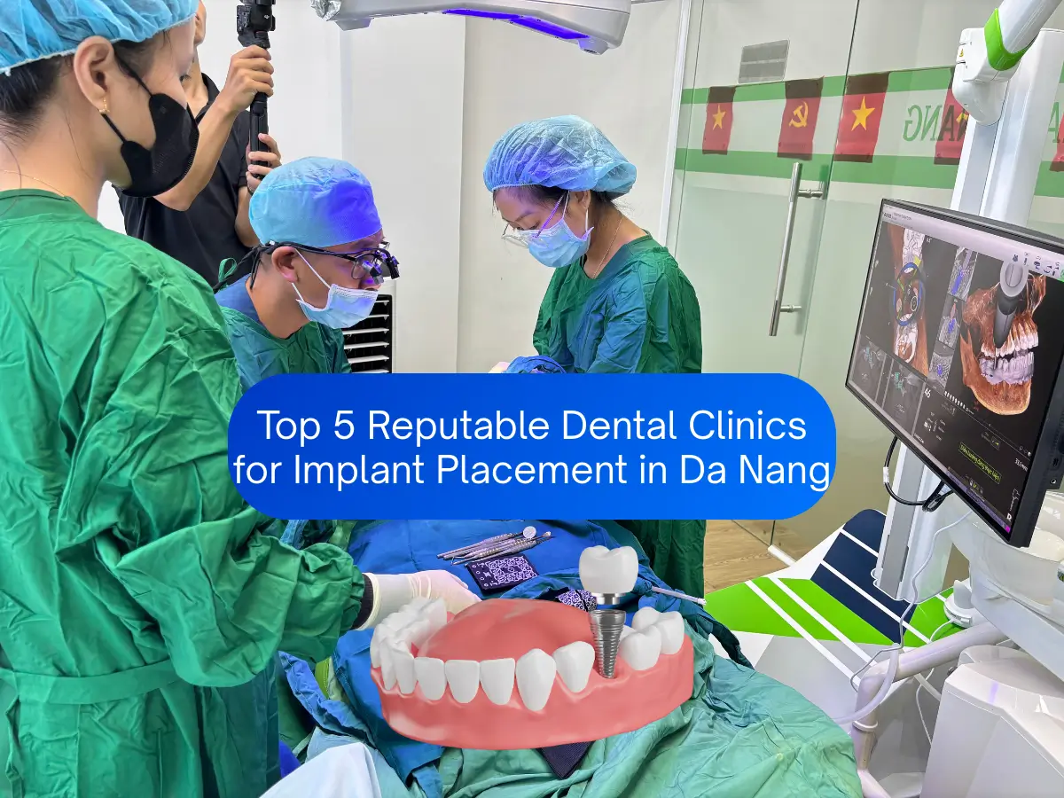 Top 5 Reputable Dental Implant Clinics in Da Nang (Updated 2025)