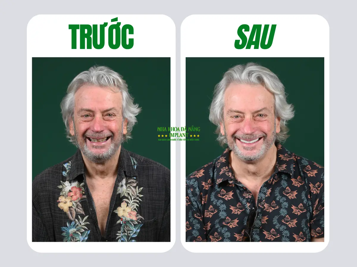 Hình ảnh khách hàng thực tế trước – sau: