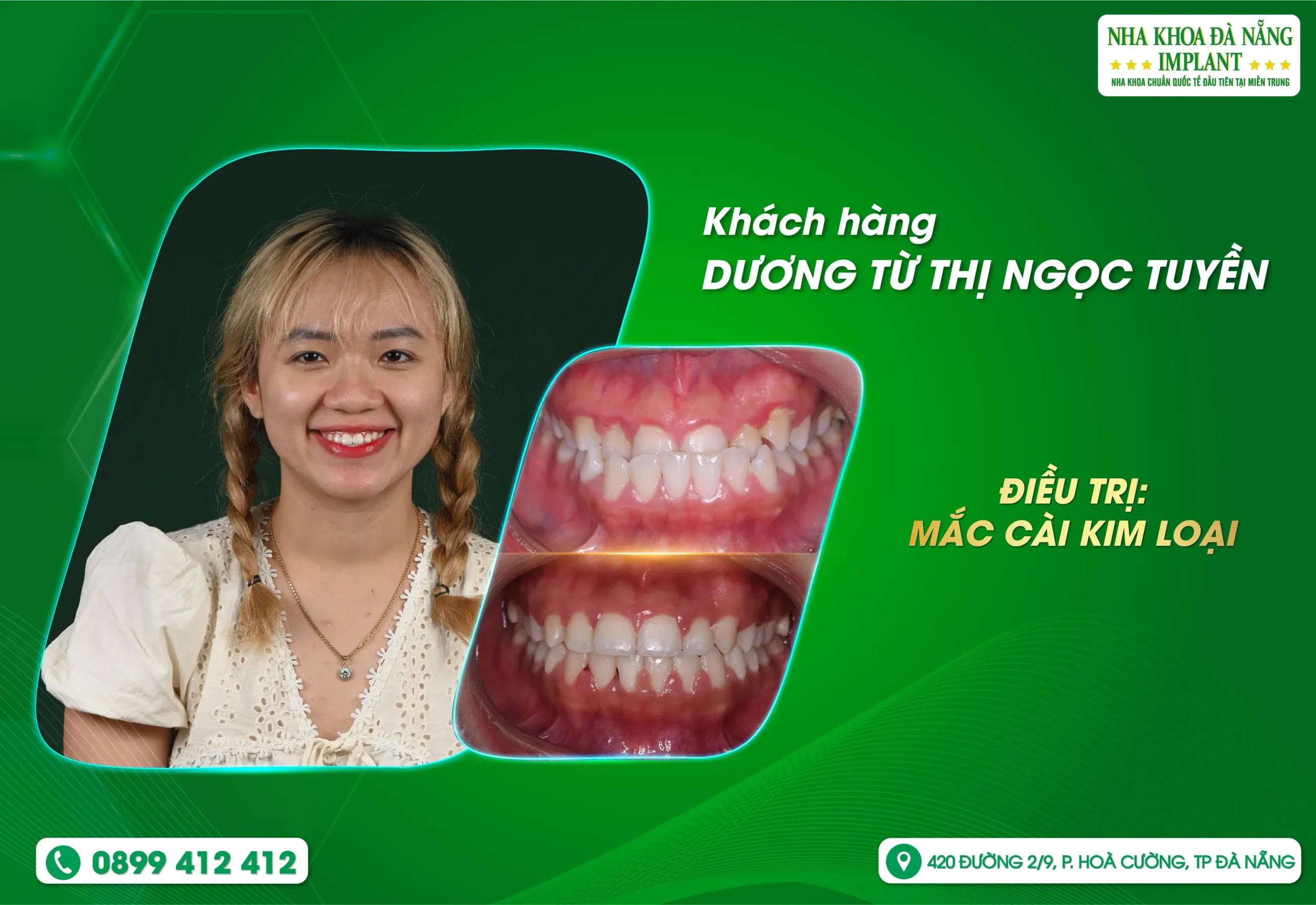 Có những thay đổi nhỏ nhưng mang đến bước ngoặt lớn trong cuộc sống