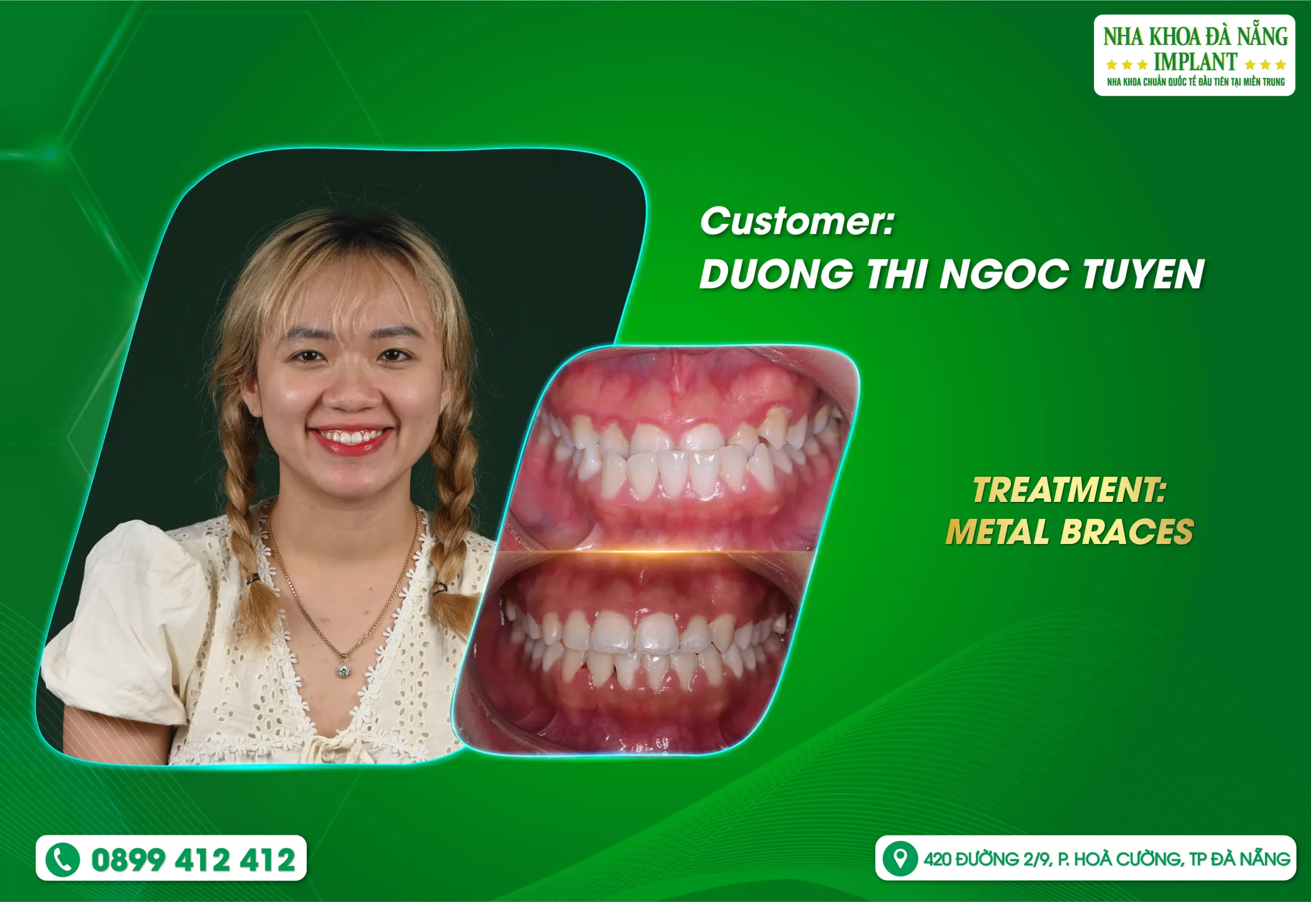 There are small changes that bring great turning points in life