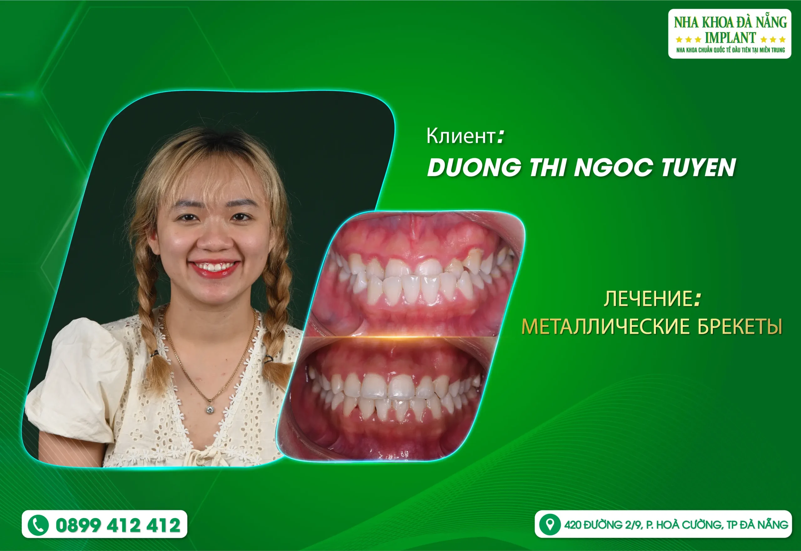 Бывают небольшие изменения, которые приводят к большим поворотам в жизни