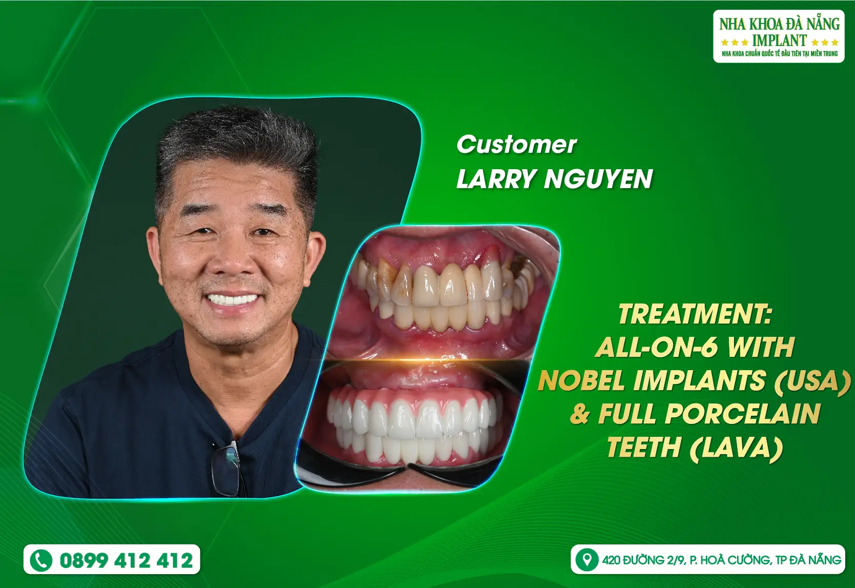 Returning home to complete a confident smile