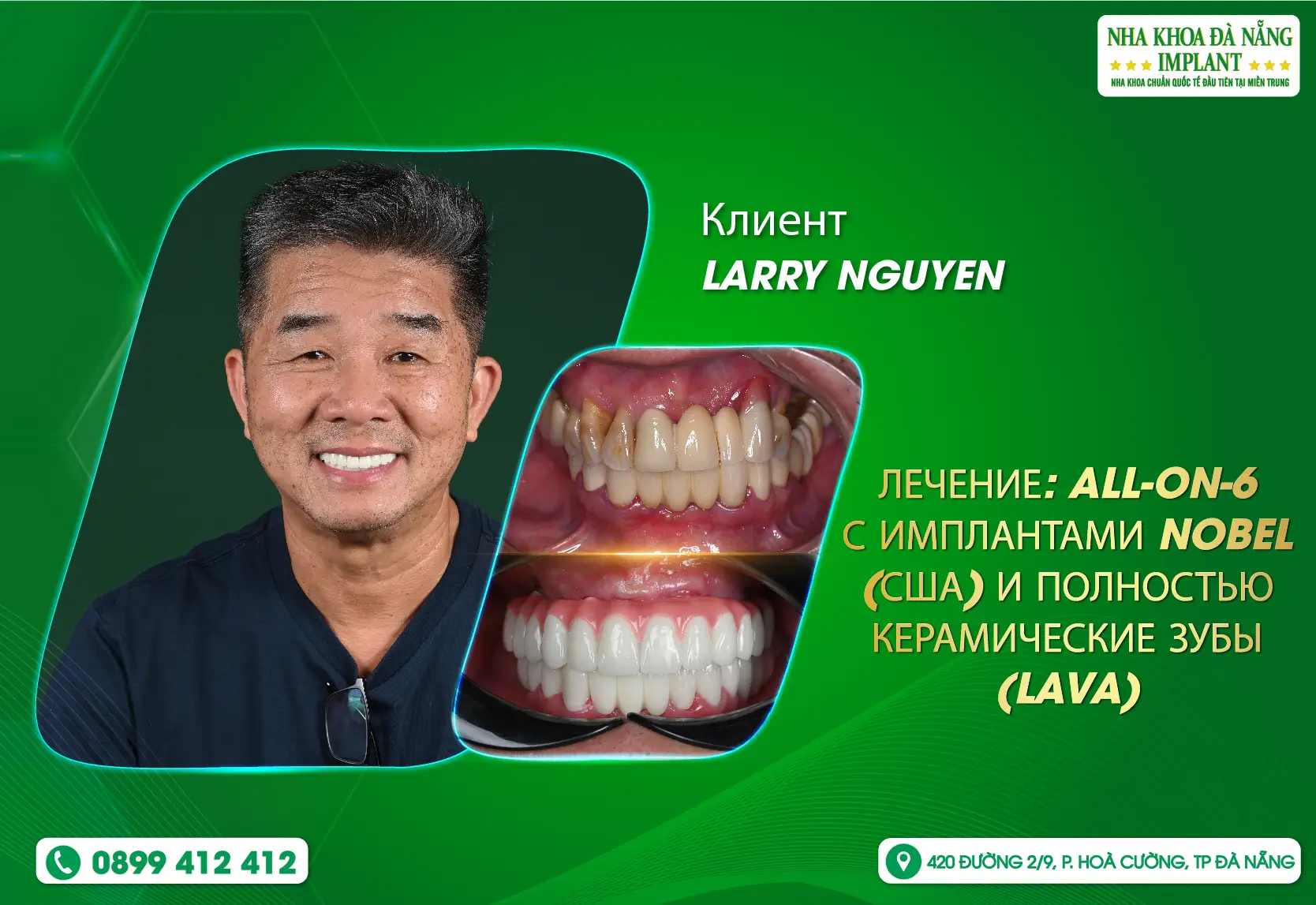 Возвращение на родину, чтобы завершить уверенную улыбку