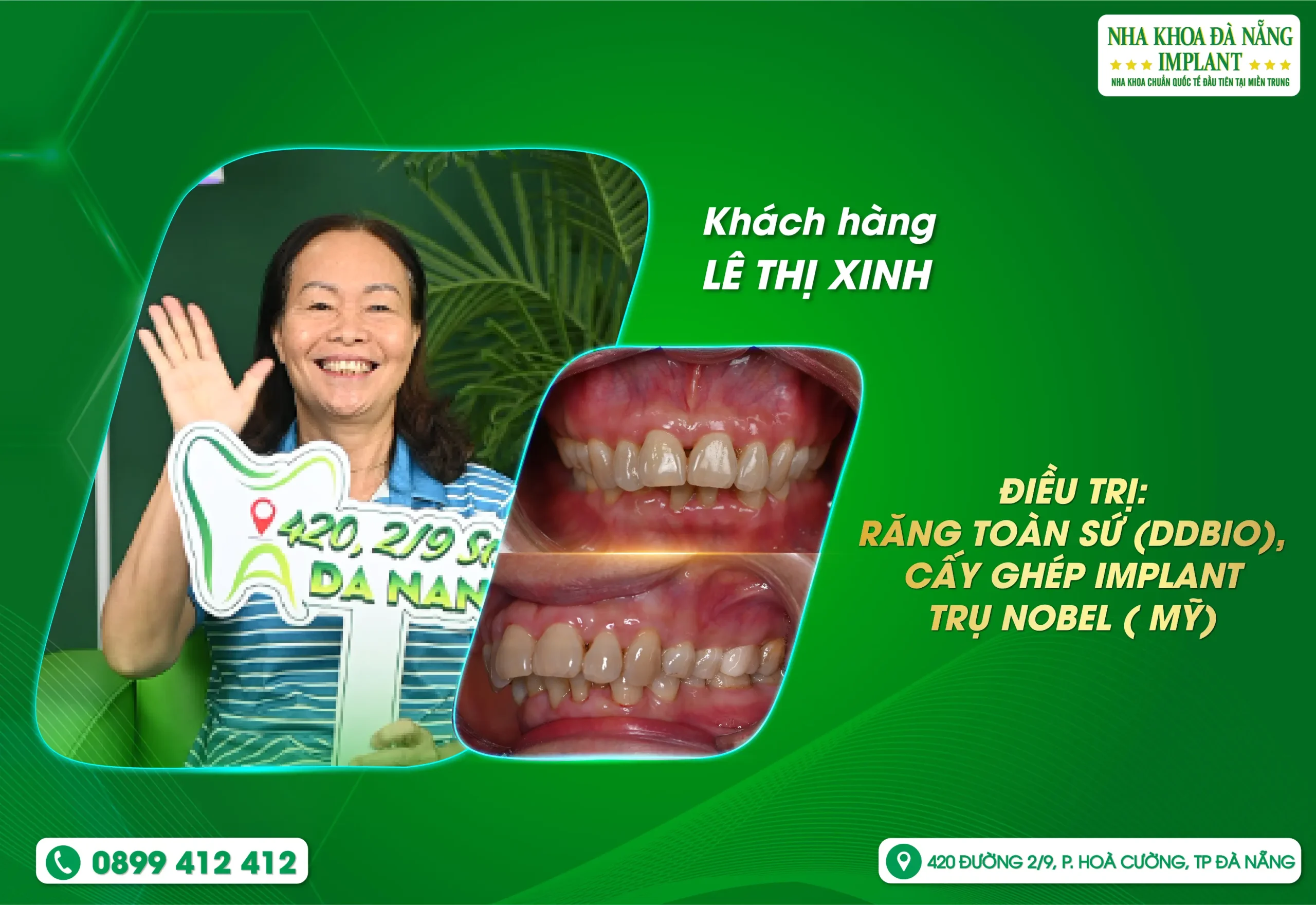 Một nụ cười đẹp chính là bí quyết để giữ mãi sự trẻ trung, tự tin, dù bạn đang ở bất kỳ độ tuổi nào