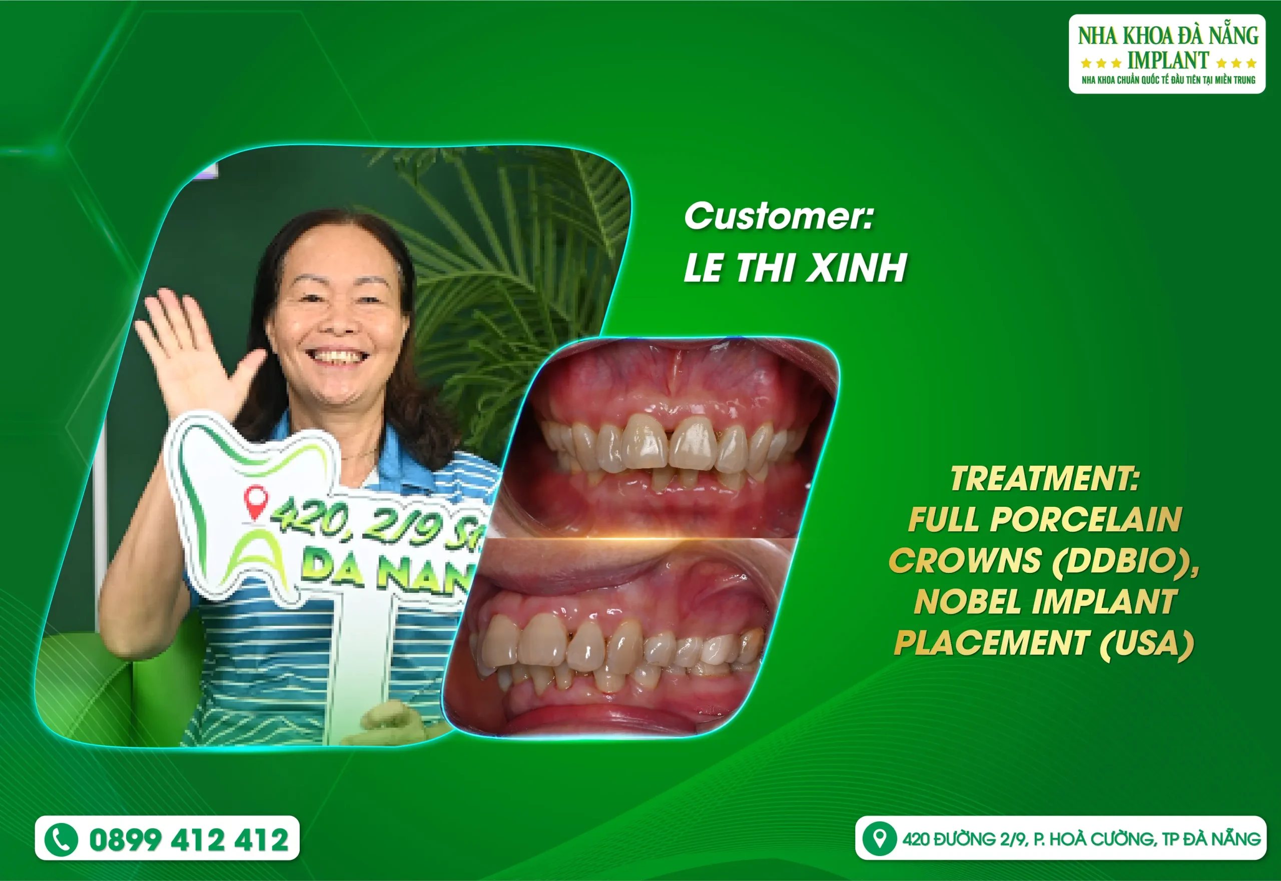 A beautiful smile is the secret to staying youthful and confident, no matter what age you are.