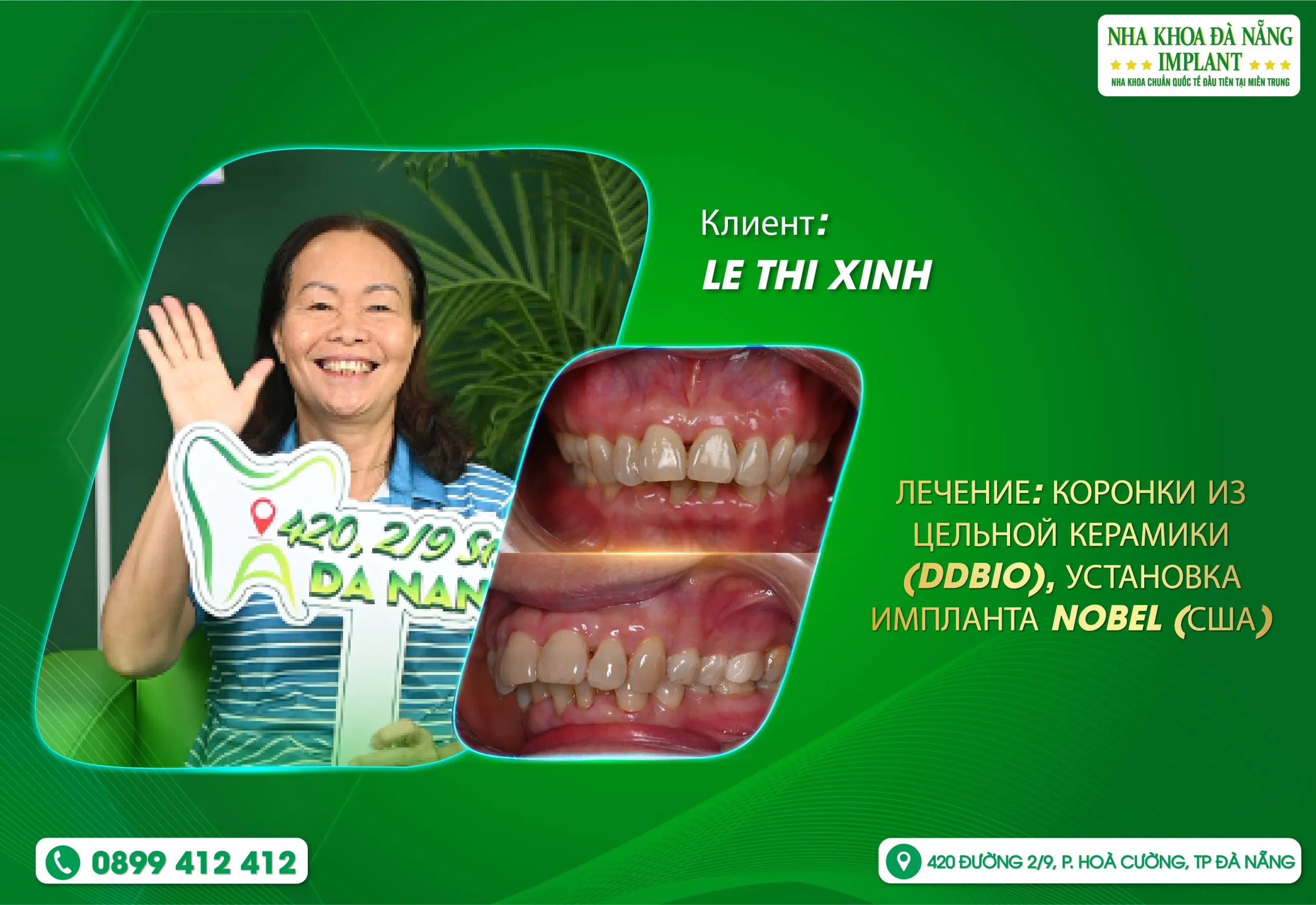 Красивая улыбка — это секрет вечной молодости и уверенности в себе, независимо от вашего возраста.