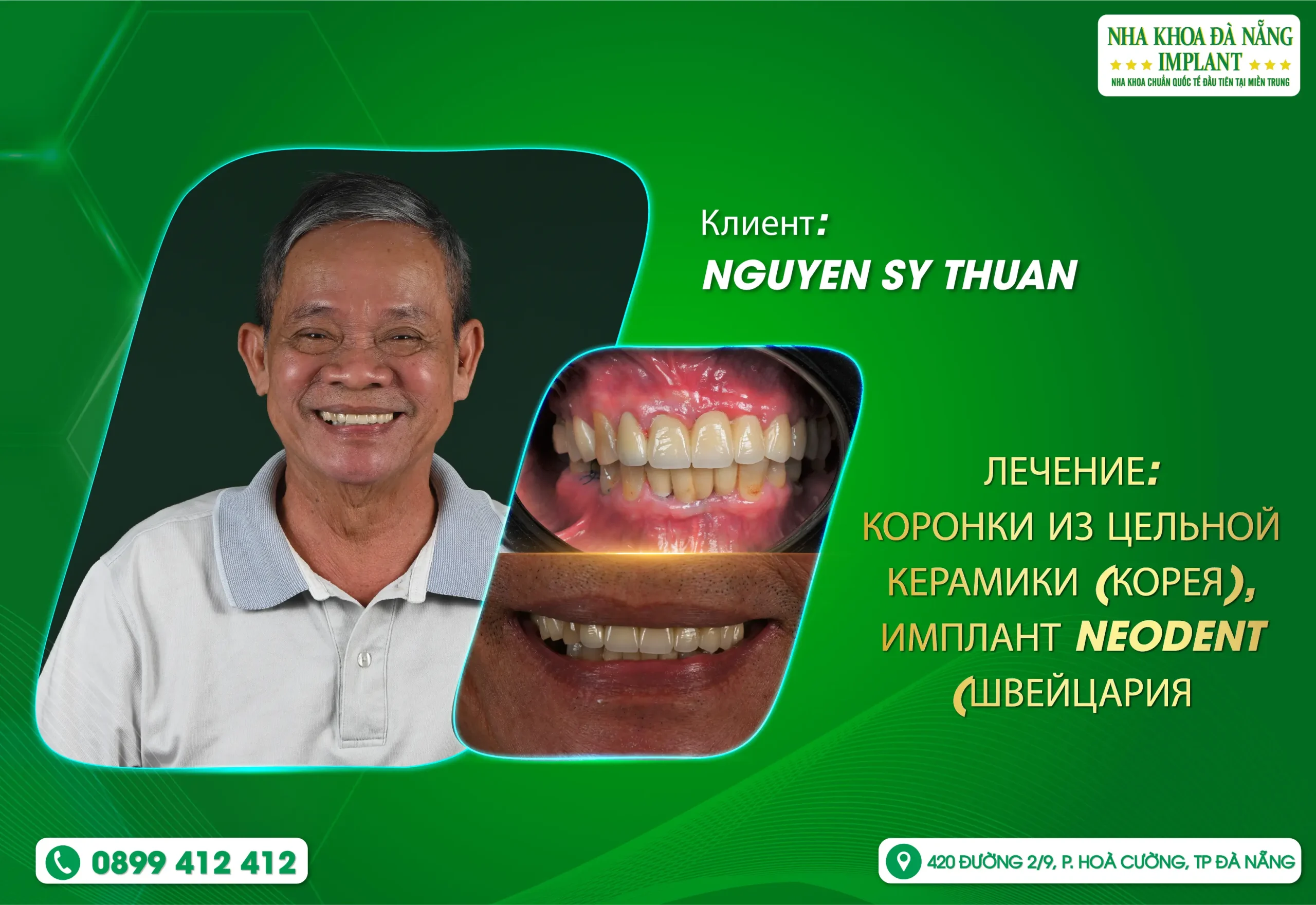 Верните улыбку – Восстановите уверенность в 80 лет