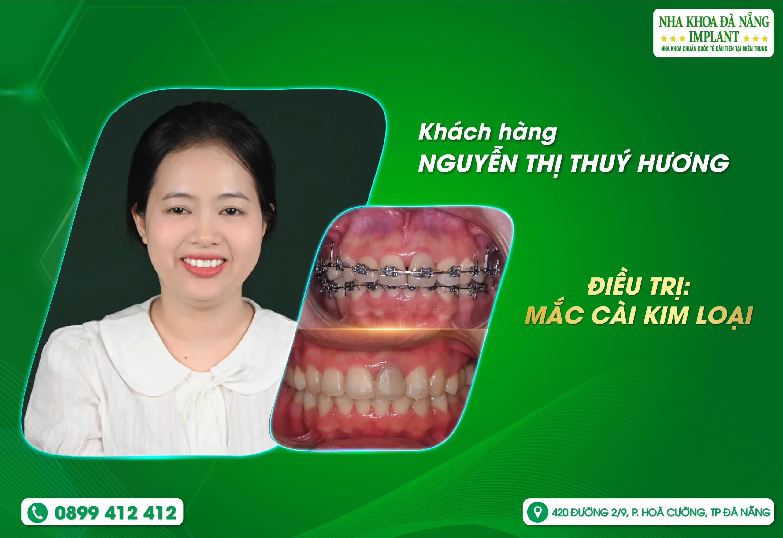 Một trong những vị khách đầu tiên đã tin tưởng và đồng hành cùng chúng tôi