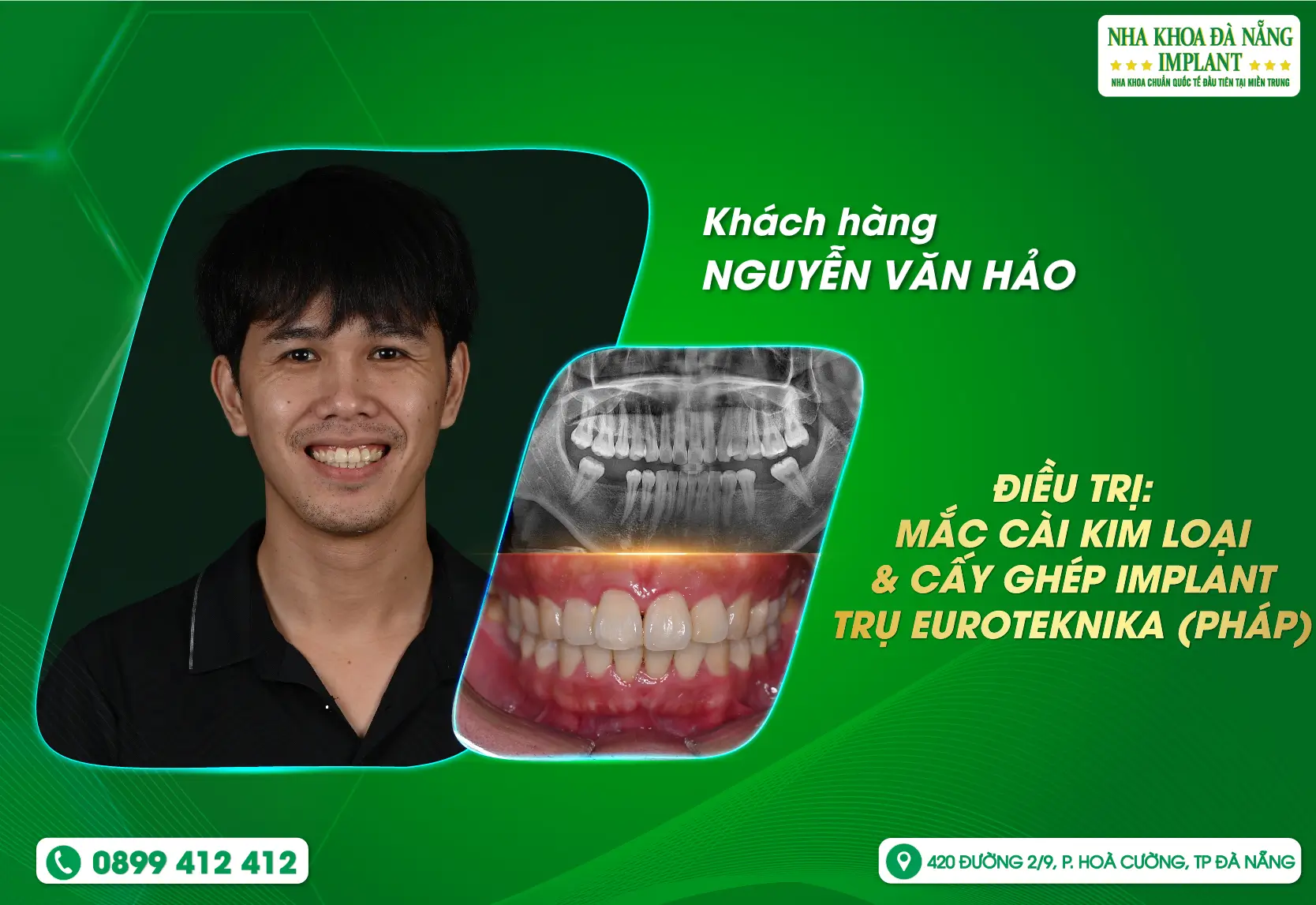 Khi sự thay đổi được khắc hoạ bằng nụ cười trọn vẹn