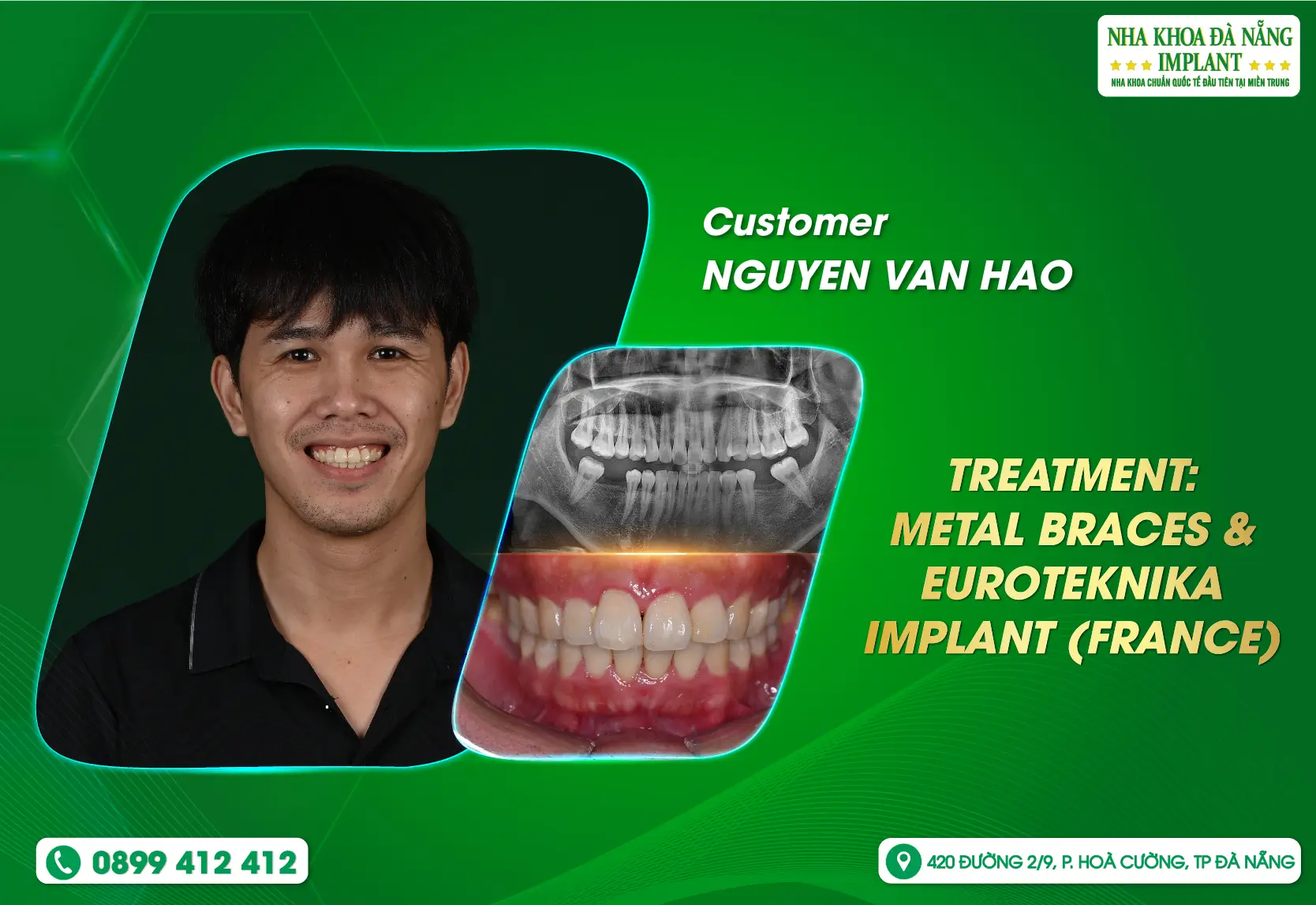 When change is portrayed through a perfect smile