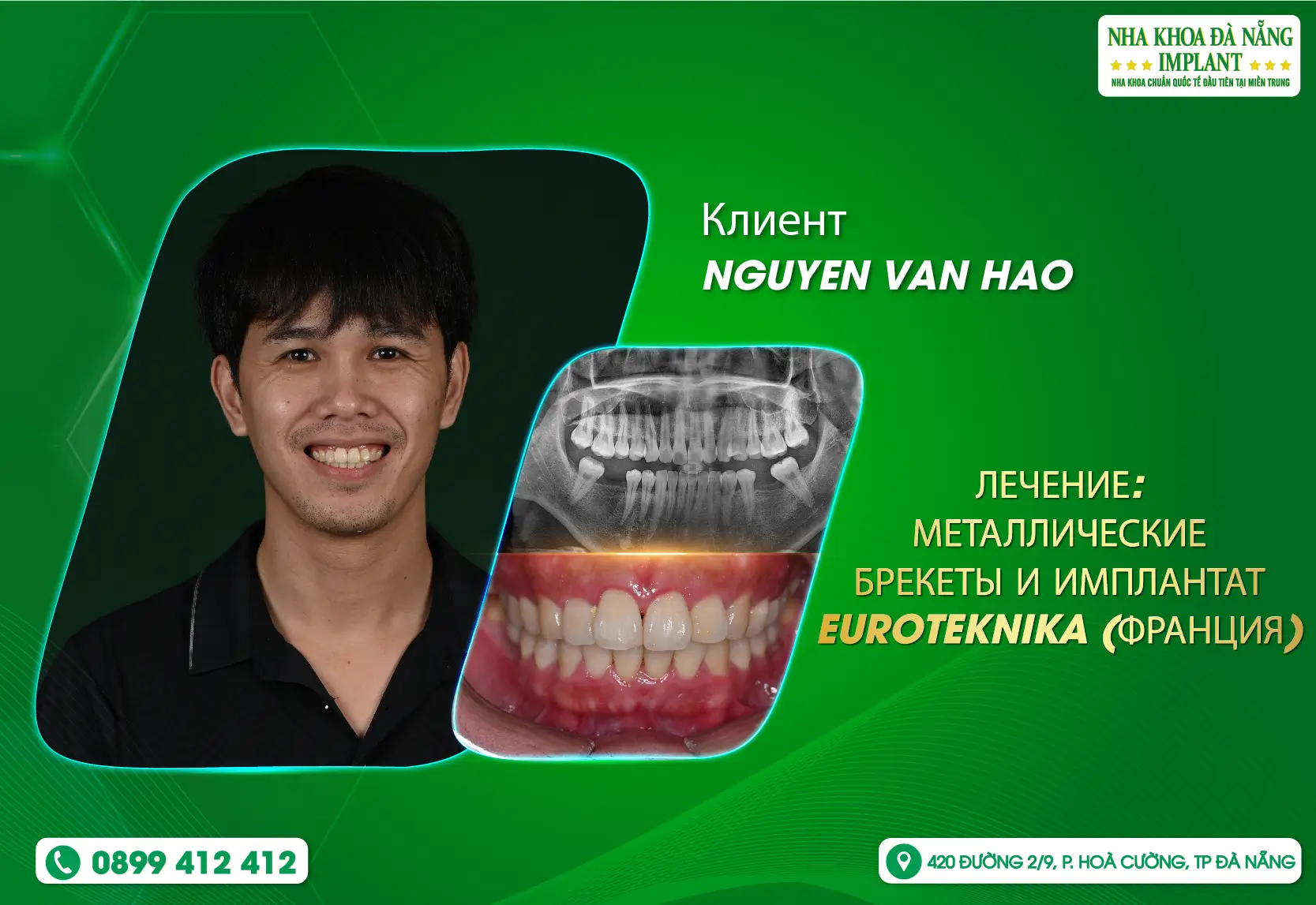 Когда перемены воплощаются в совершенной улыбке