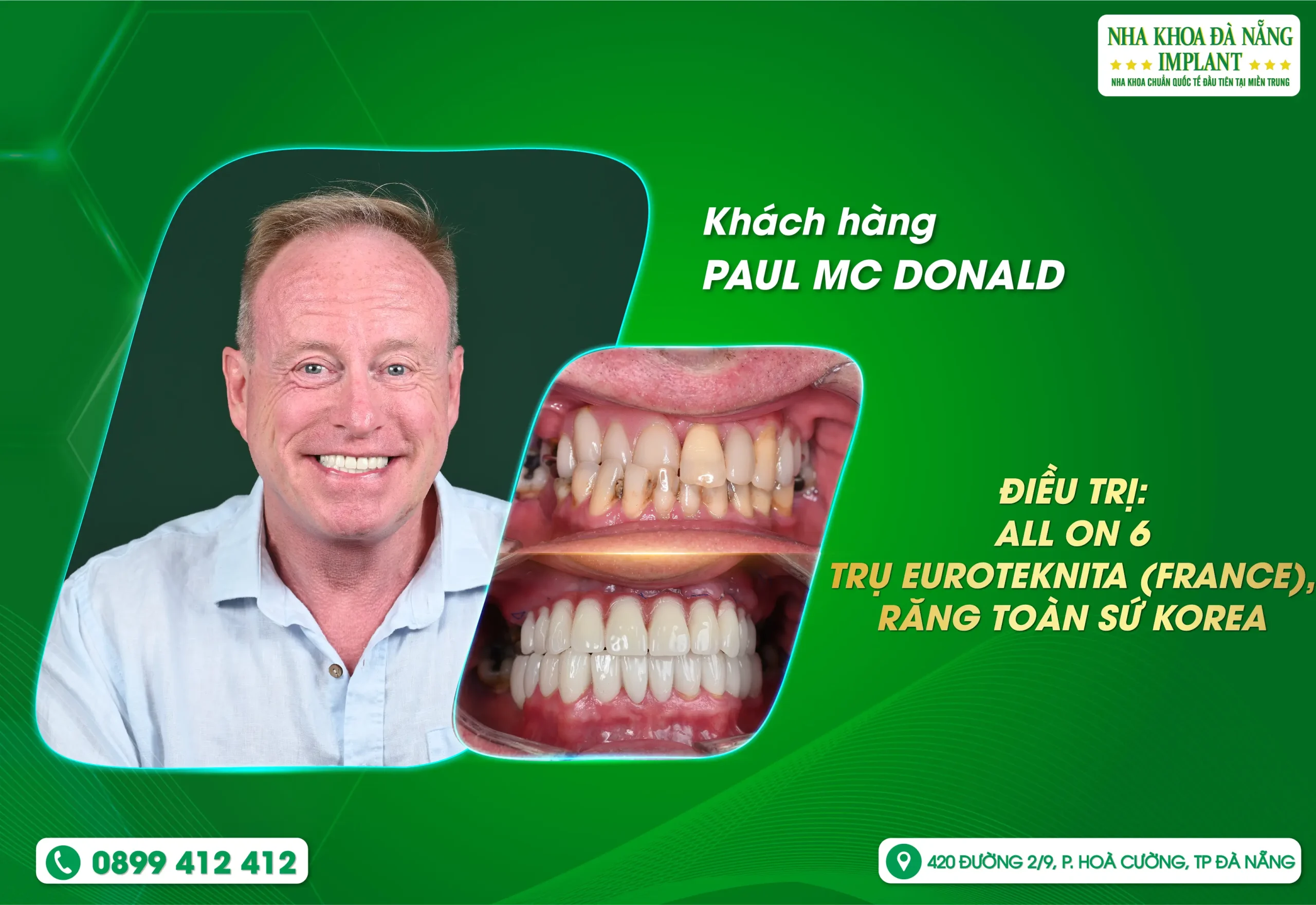 “Tôi rất cảm thấy may mắn khi đã tìm đến nha khoa này