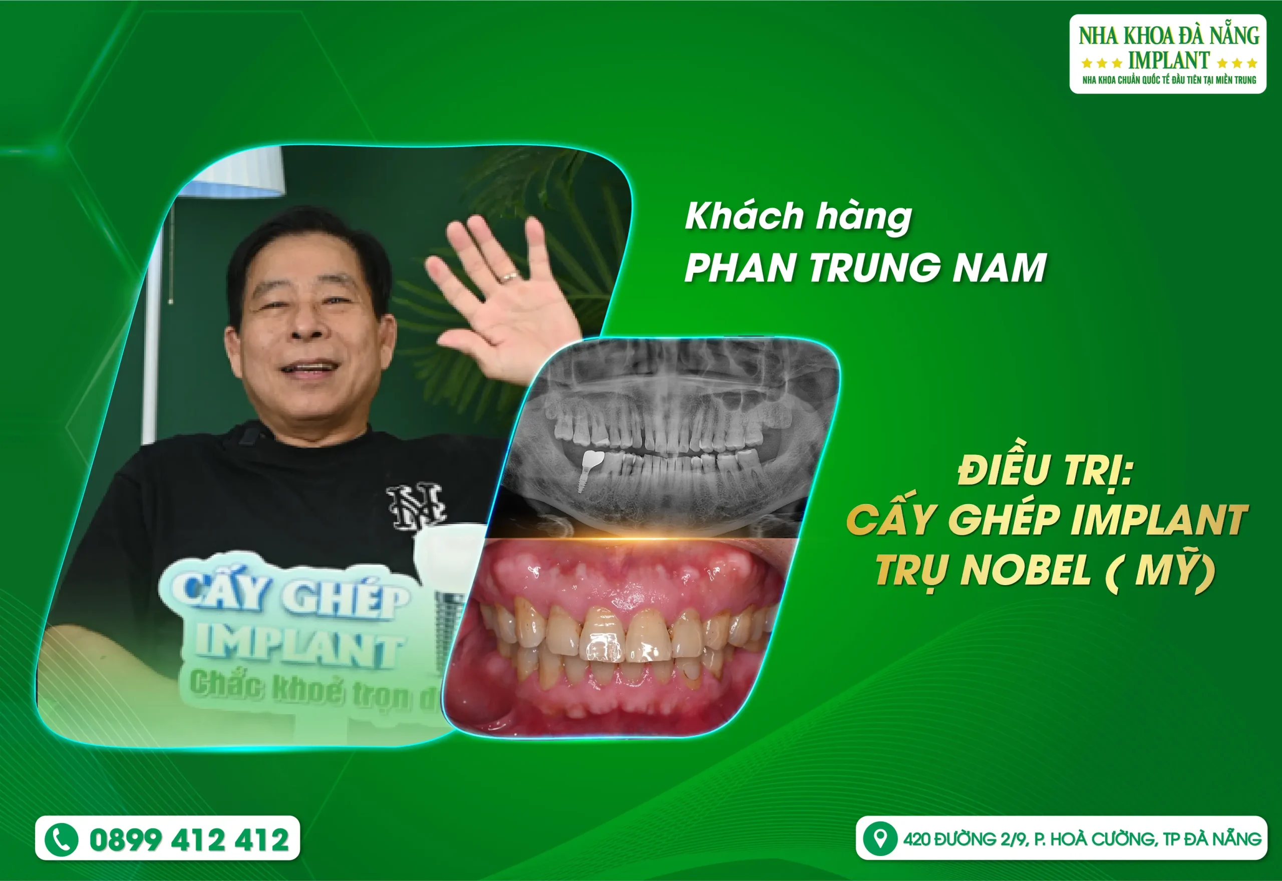 Hành trình vượt nửa địa cầu để tìm lại nụ cười Việt