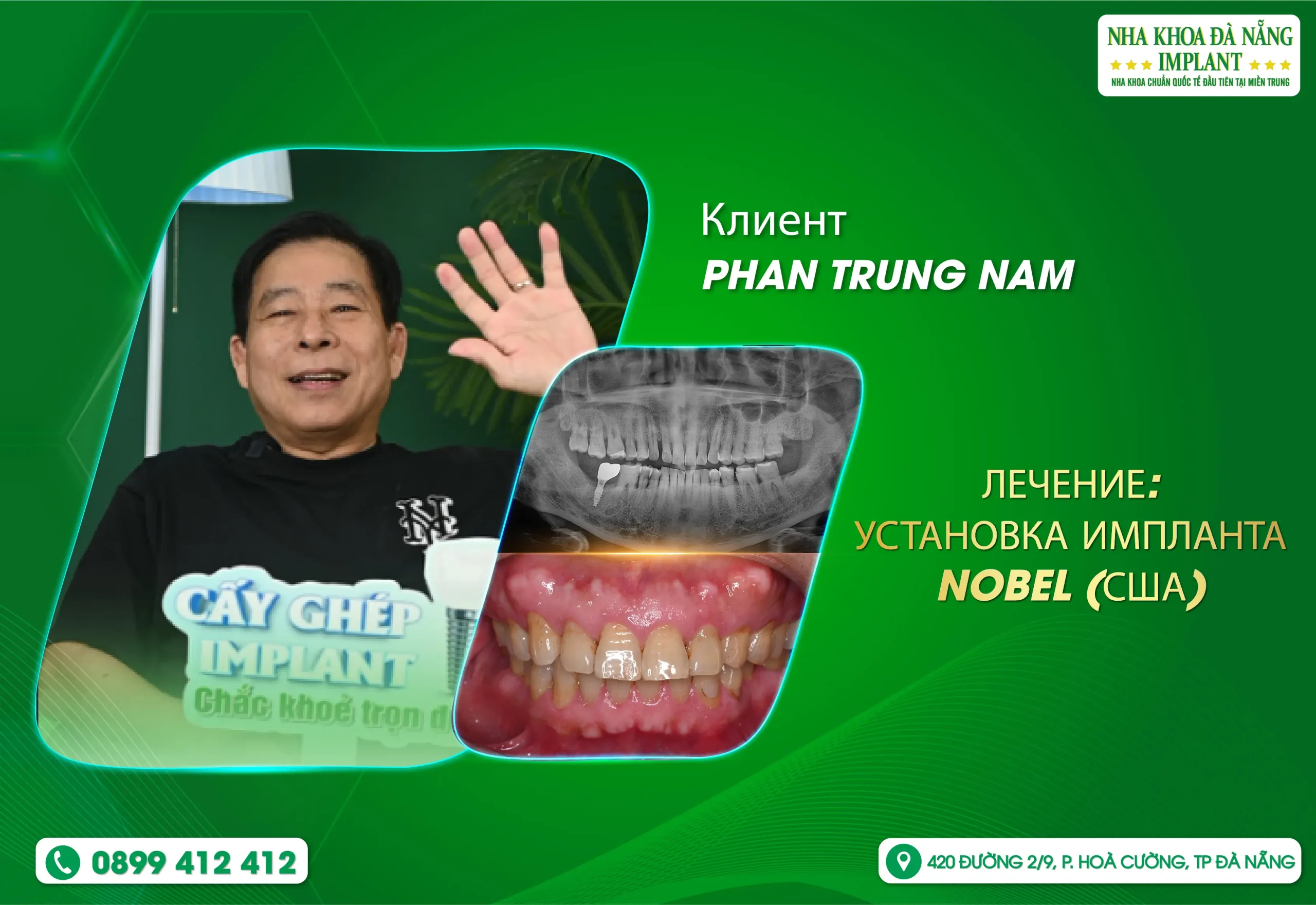 Путешествие «Через полмира», чтобы вернуть Вьетнамскую улыбку