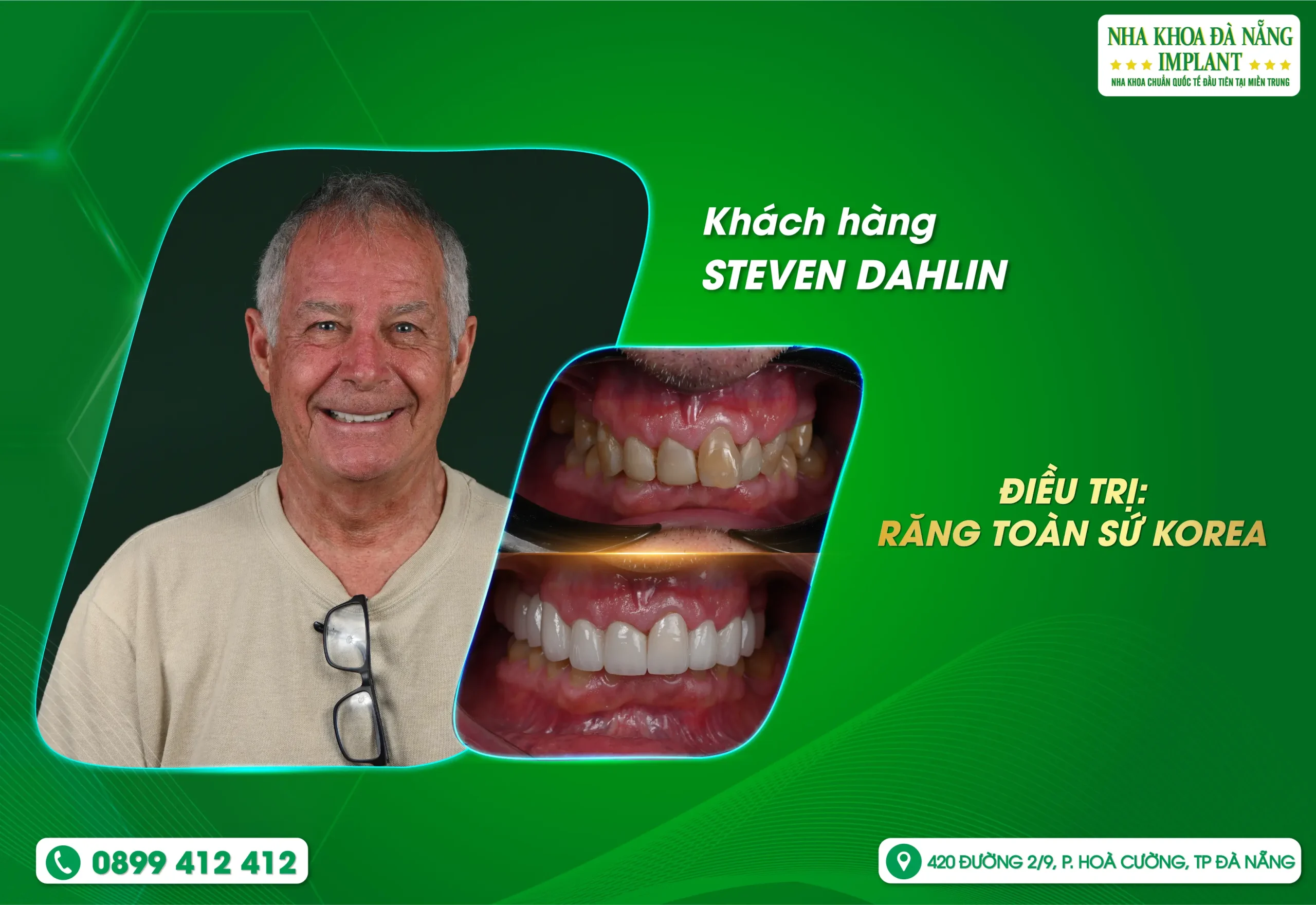 Mỗi nụ cười đẹp đều bắt đầu từ sự tin tưởng