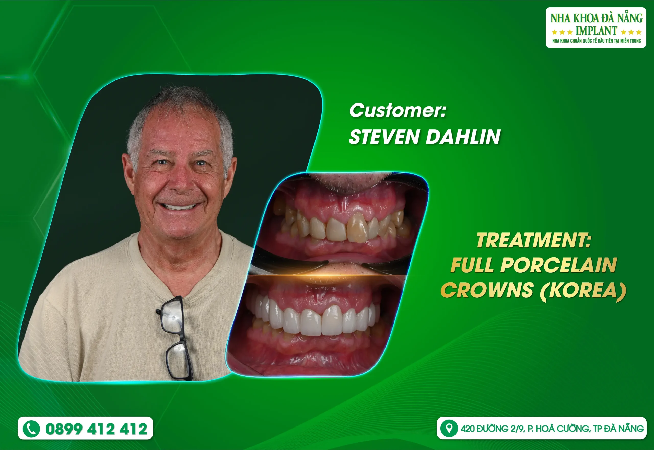 Every beautiful smile begins with trust