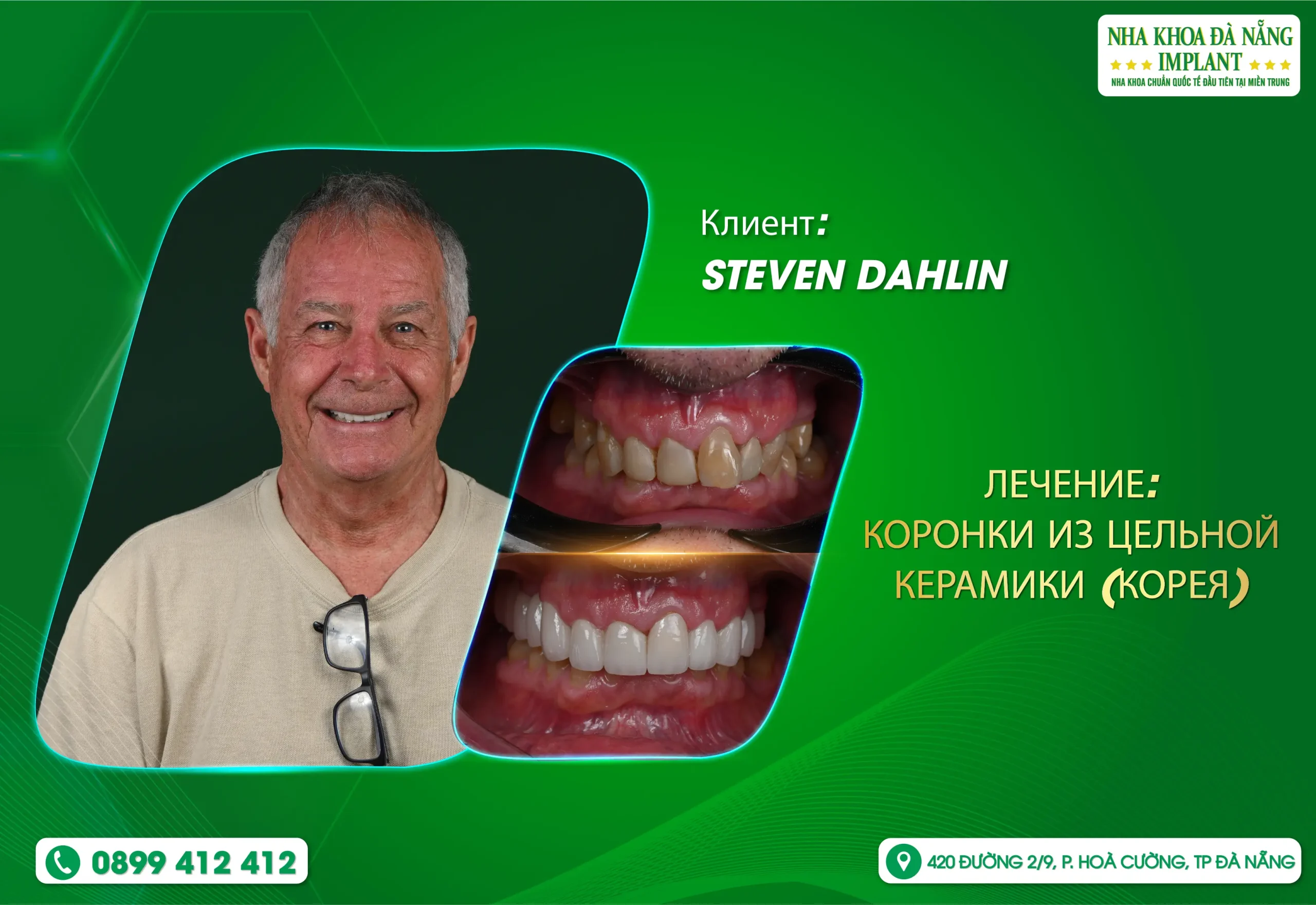 Каждая красивая улыбка начинается с доверия.