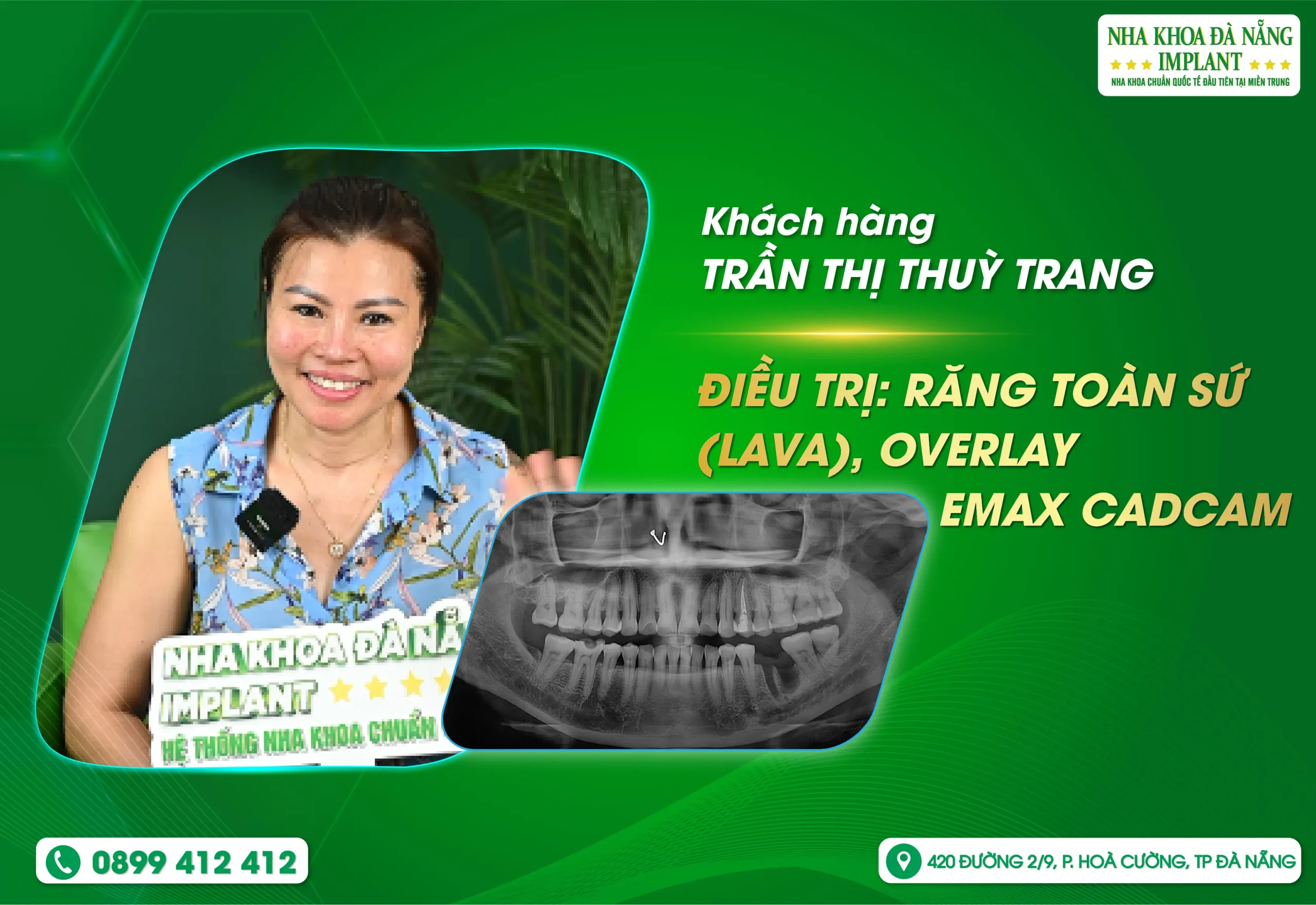 Trải nghiệm nhẹ nhàng khiến khách hàng an tâm