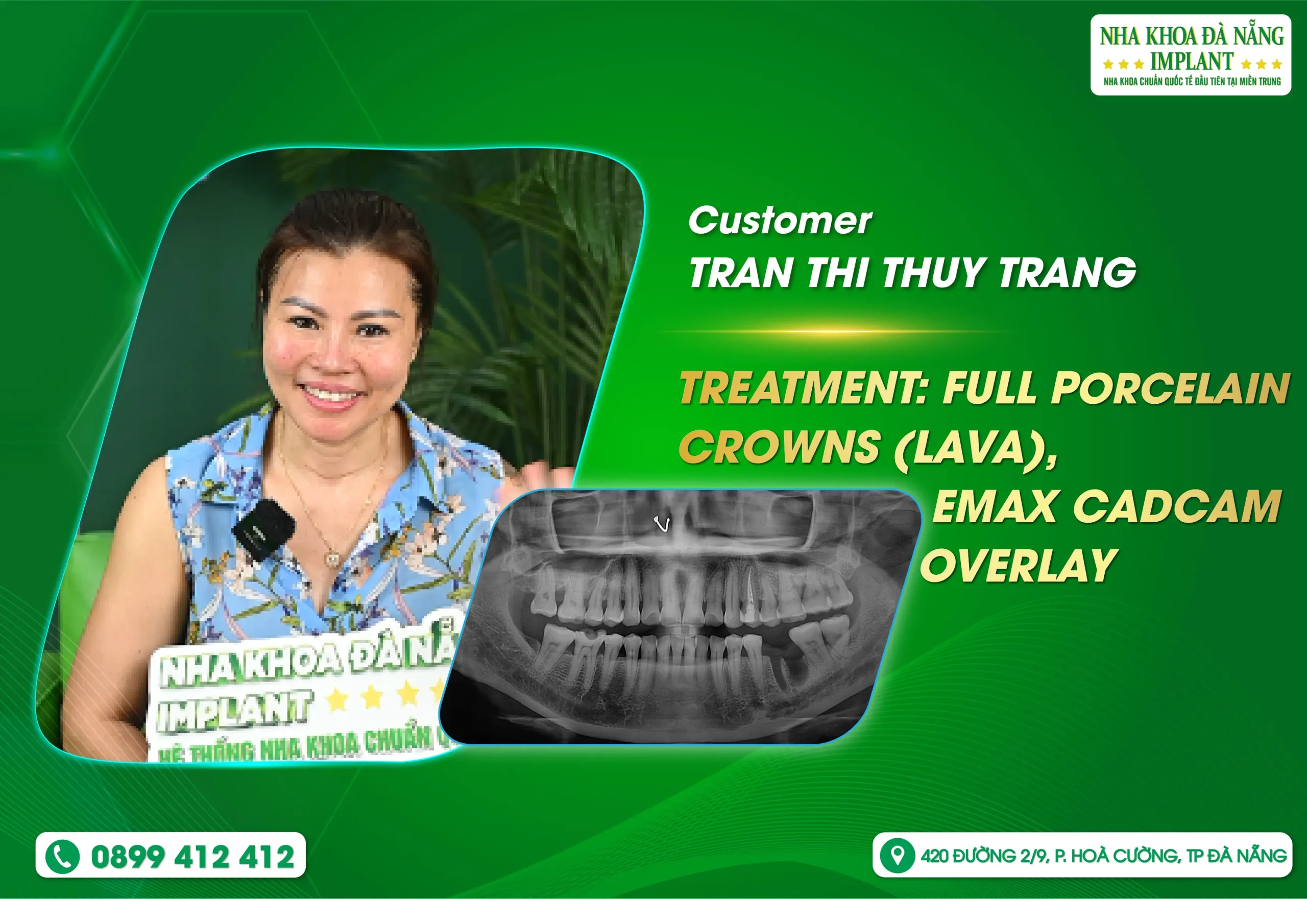 A Gentle Experience That Brings Peace of Mind to Customers