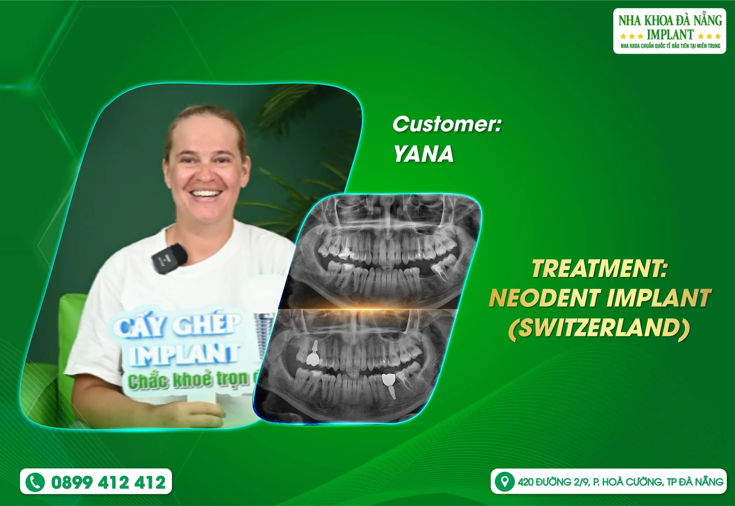 Fast – clear – dedicated: A different experience at Da Nang Implant Dental Clinic