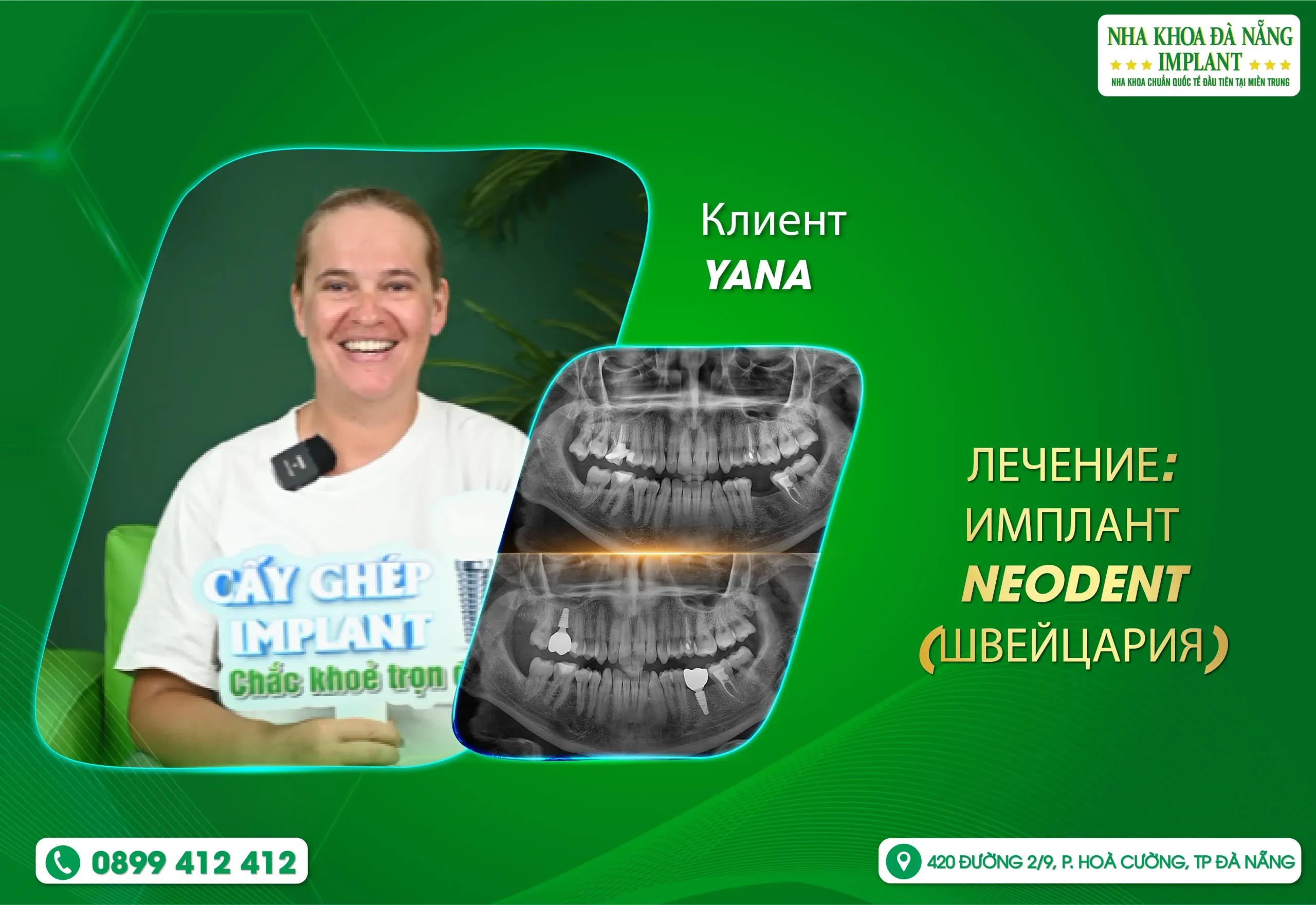 быстро – ясно – с заботой: особый опыт в стоматологии Da Nang Implant