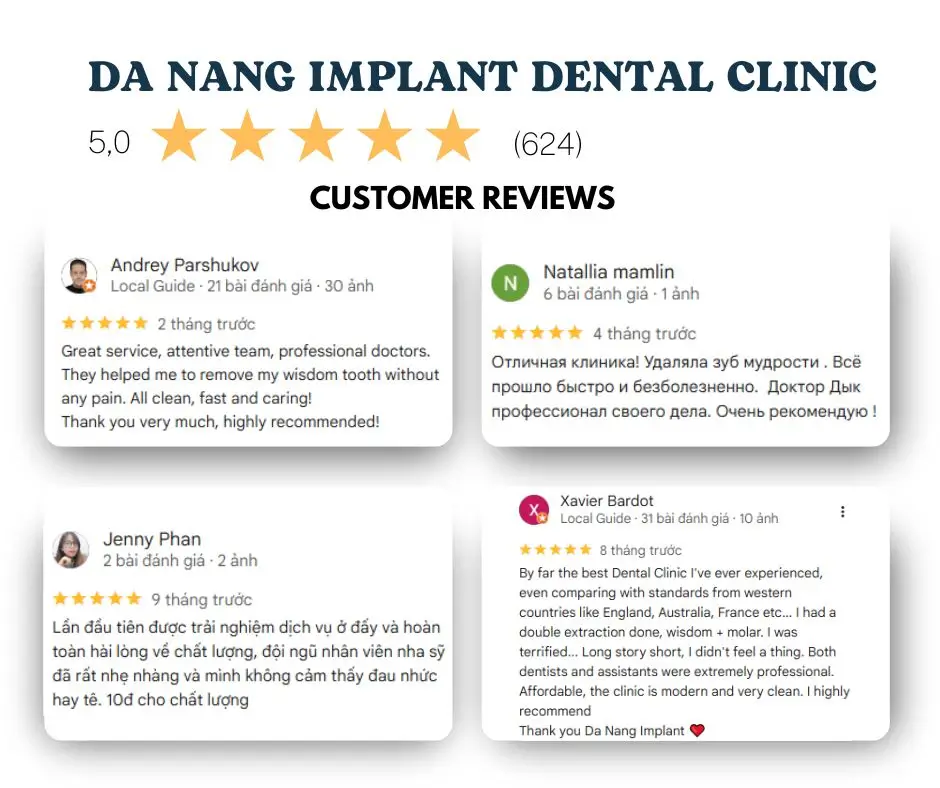 Khách hàng nói gì khi trải nghiệm nhổ răng tại Nha Khoa Đà Nẵng Implant