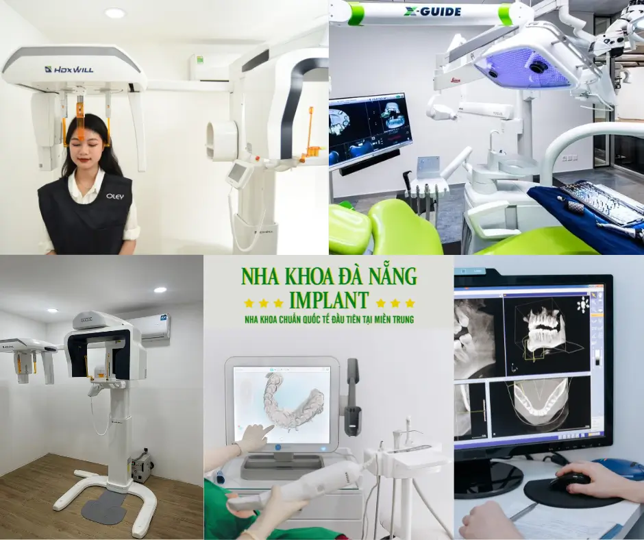 International standard dental implant – Save up to 70% of costs for overseas Vietnamese at Da Nang Implant Dental Clinic 9 Modern Technology & Equipment at Da Nang Implant Dental Clinic