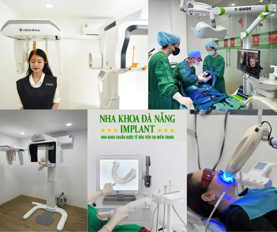 Узнайте, почему стоматологическая клиника Da Nang Implant привлекает иностранных клиентов.