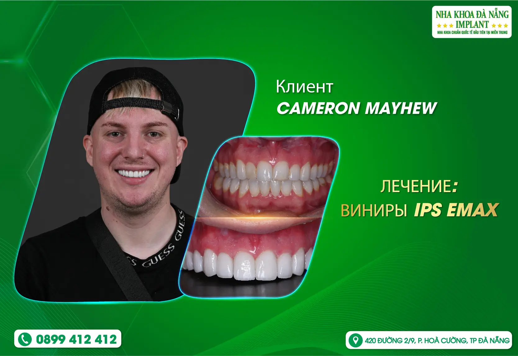 «Здесь к вам относятся как к королевской особе», — поделился клиент CAMERON MAYHEW.