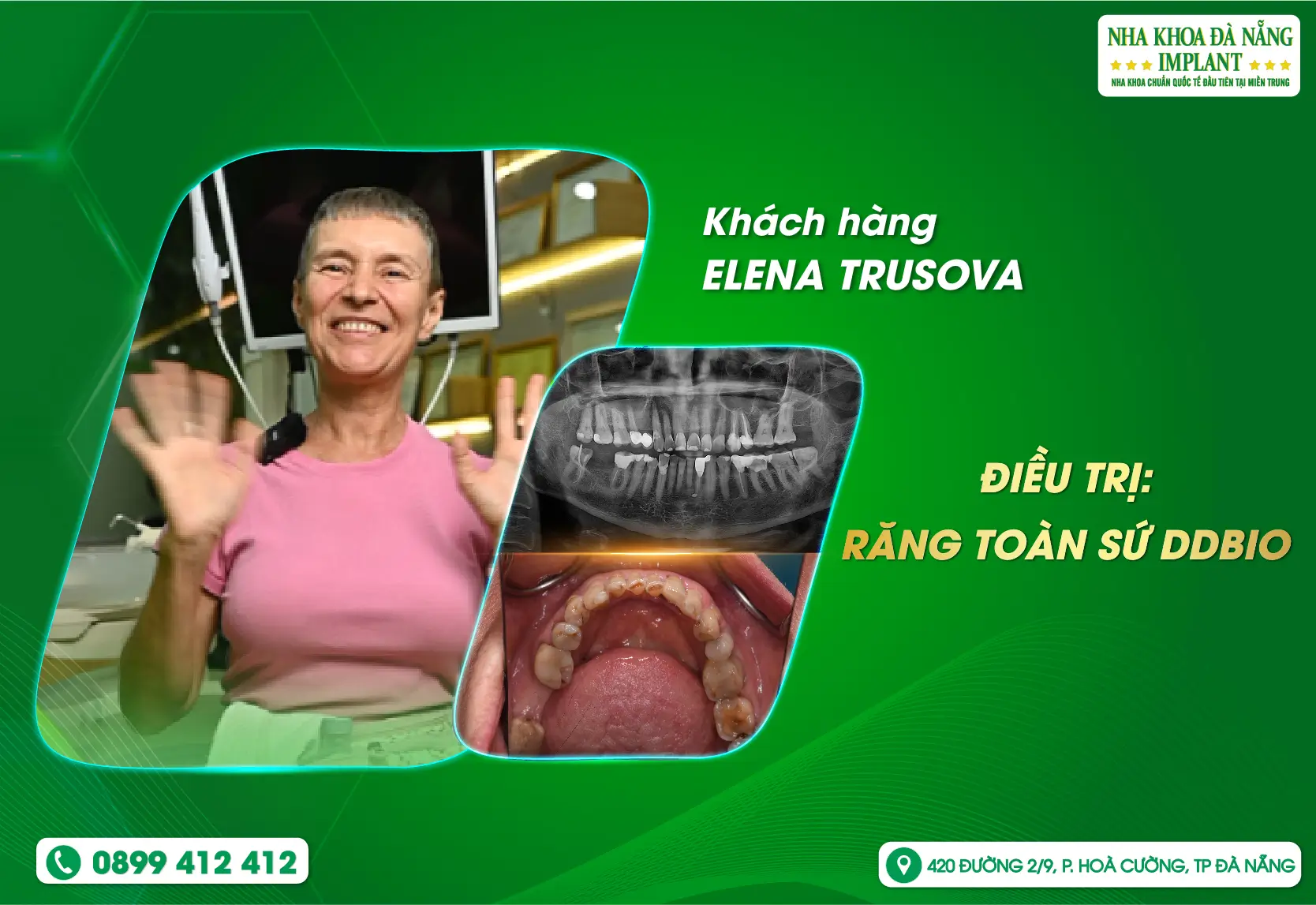 Khi nụ cười của bạn được lắng nghe