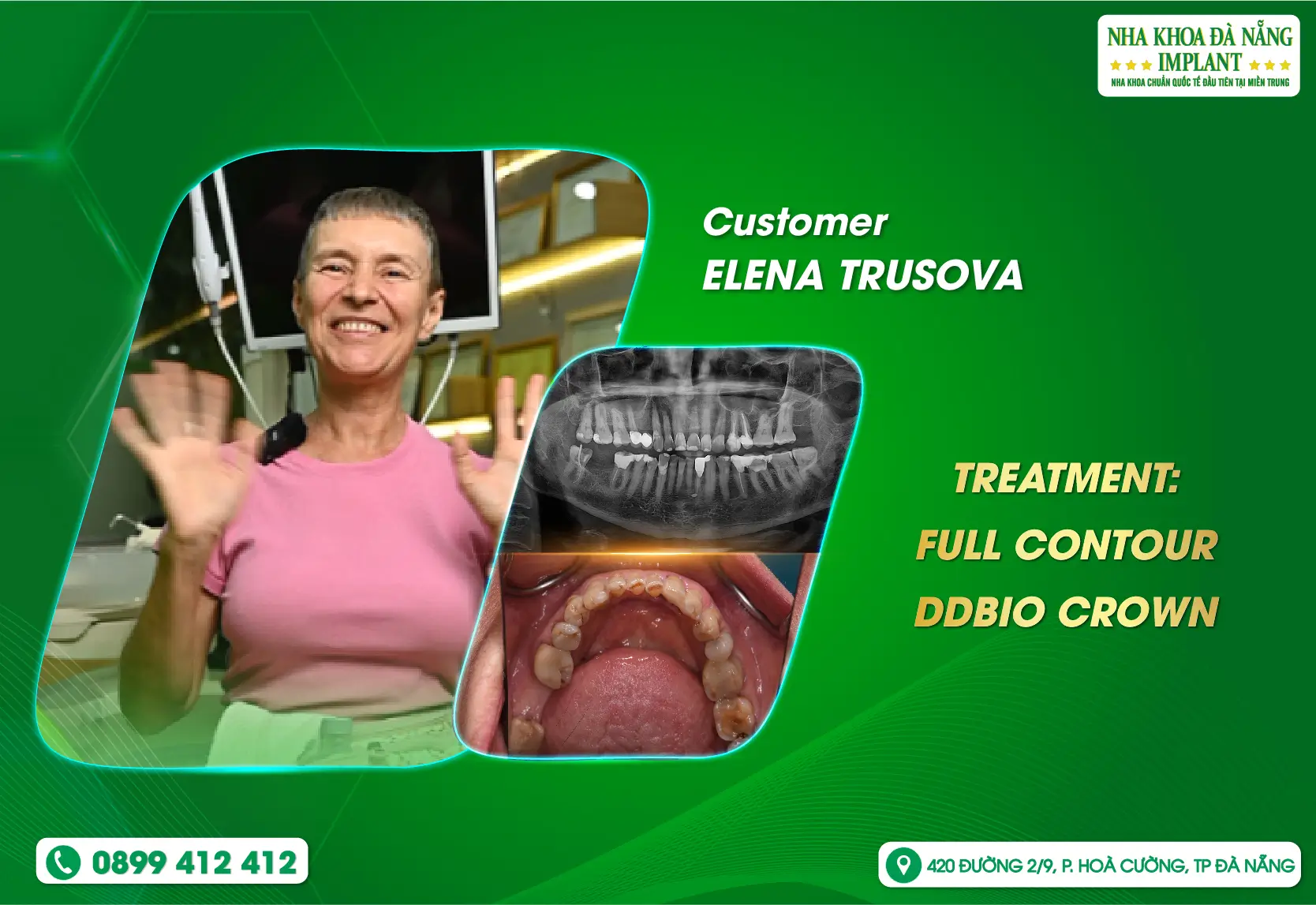 When your smile is truly heard