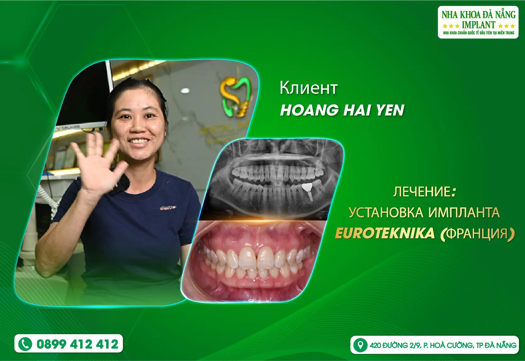 Секрет восстановления жевательной функции и здоровой улыбки