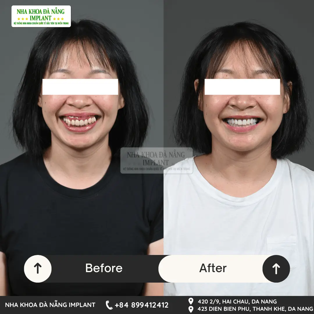 Customer: Nguyen Thi Ngoc