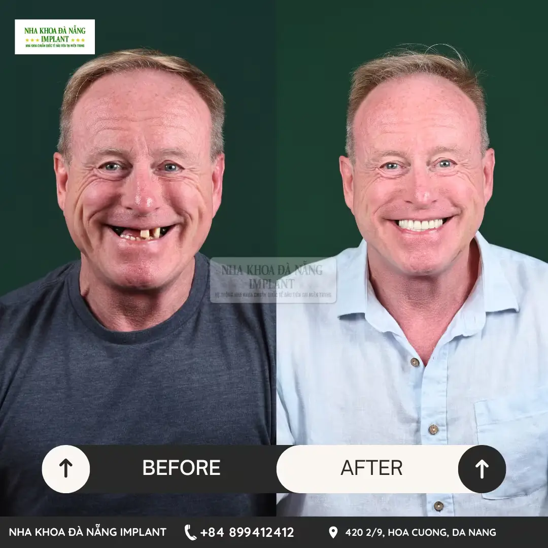 Patient: PAUL MC DONALD