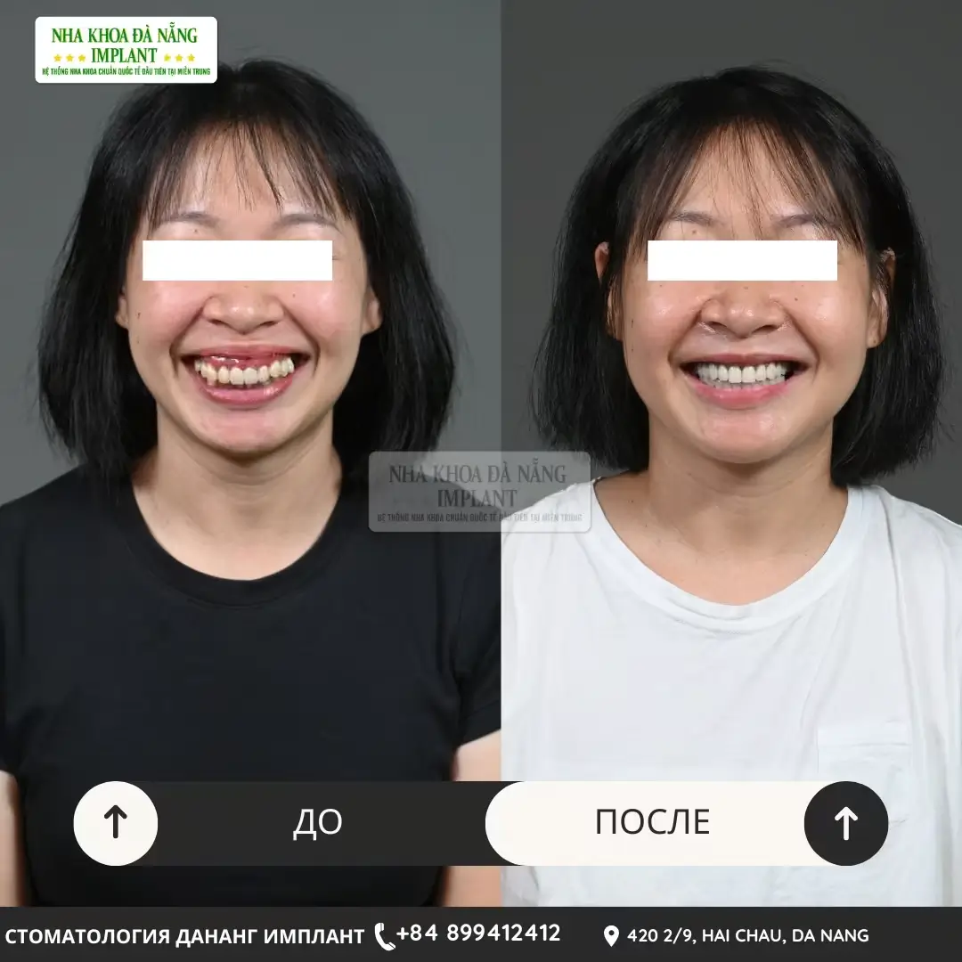 Клиент: Nguyen Thi Ngoc