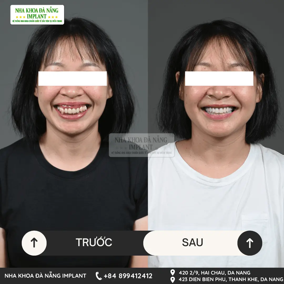 Khách hàng Nguyễn Thị Ngọc