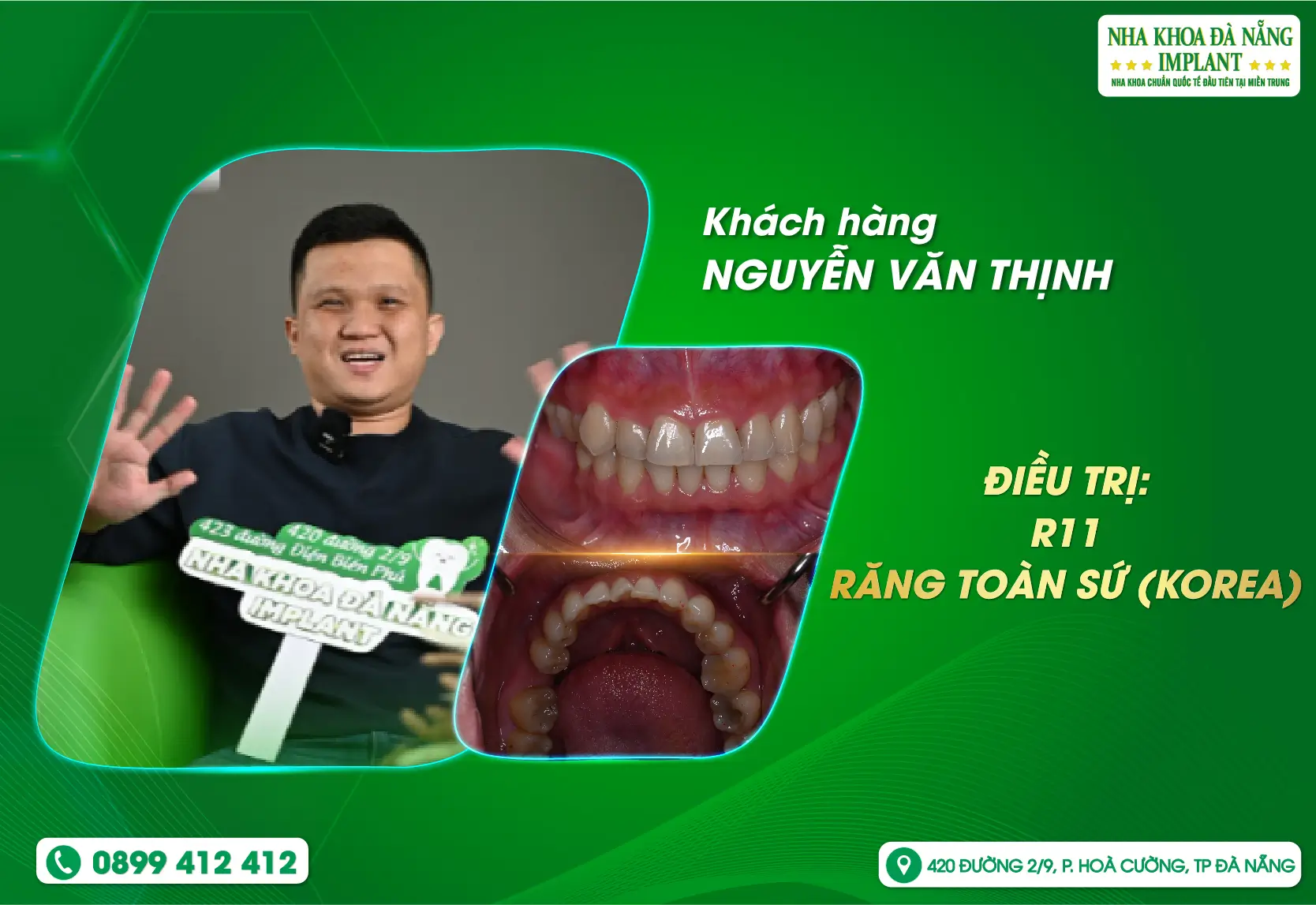 Tìm lại nụ cười tự tin chỉ sau 2 lần hẹn