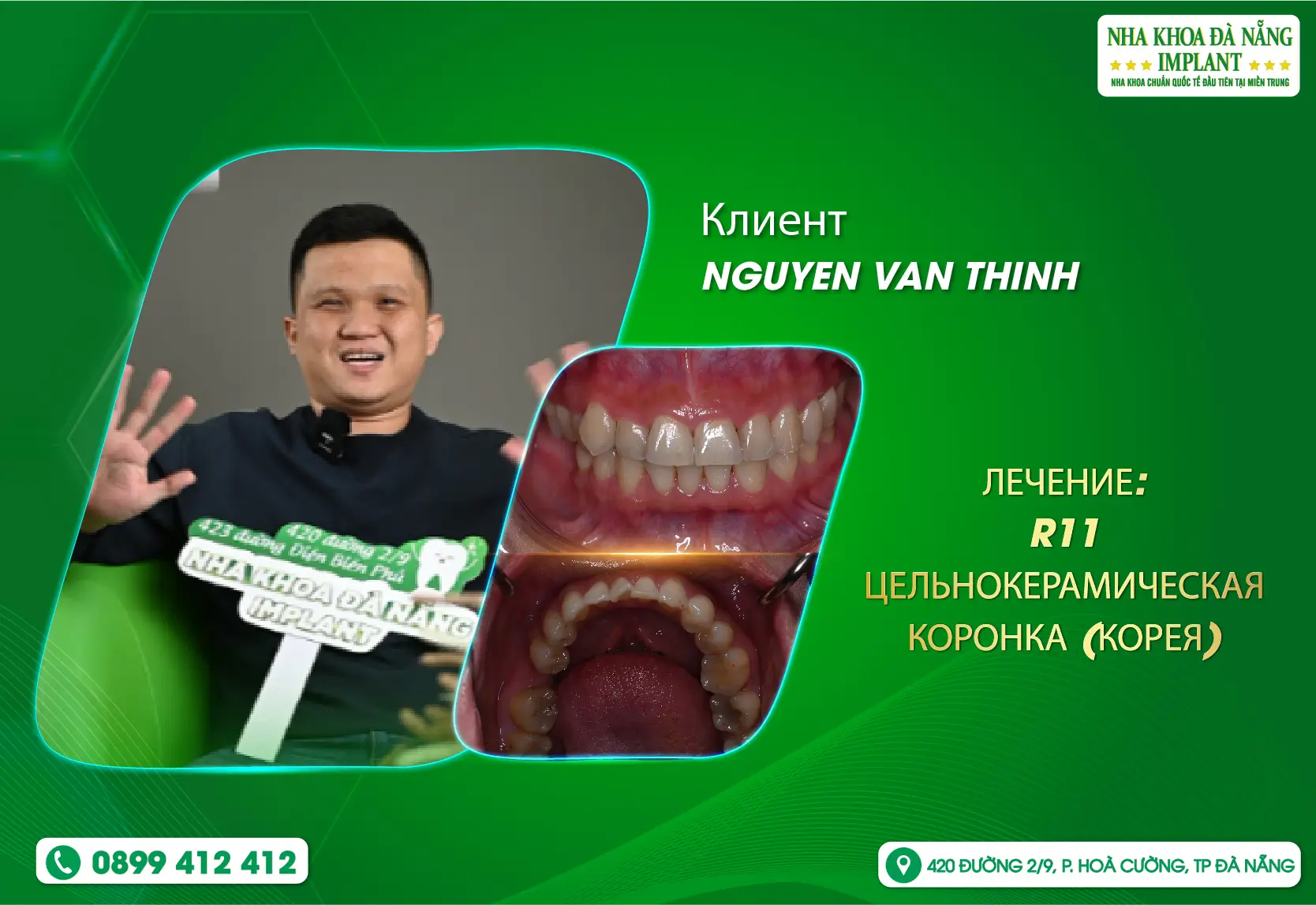 Верните свою уверенную улыбку всего после двух приёмов.