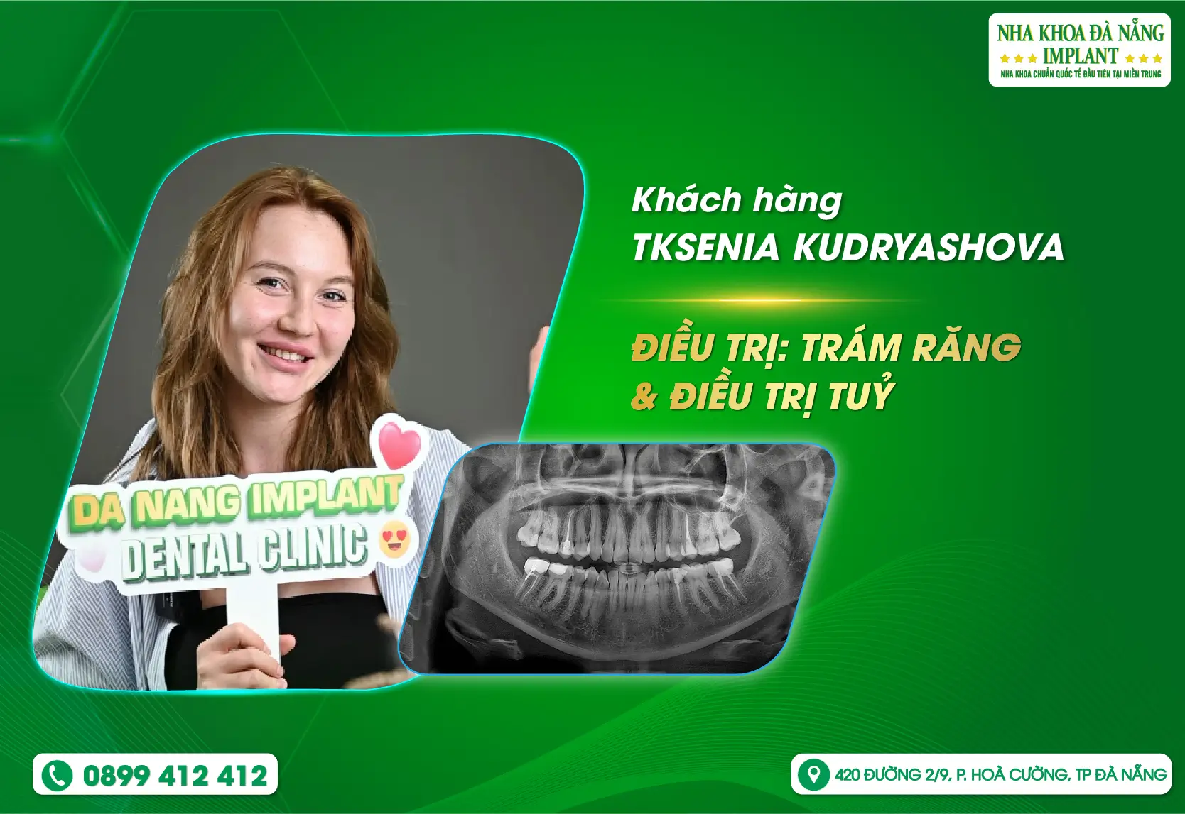 Chữa trị nhanh chóng bởi sự tận tâm của bác sĩ