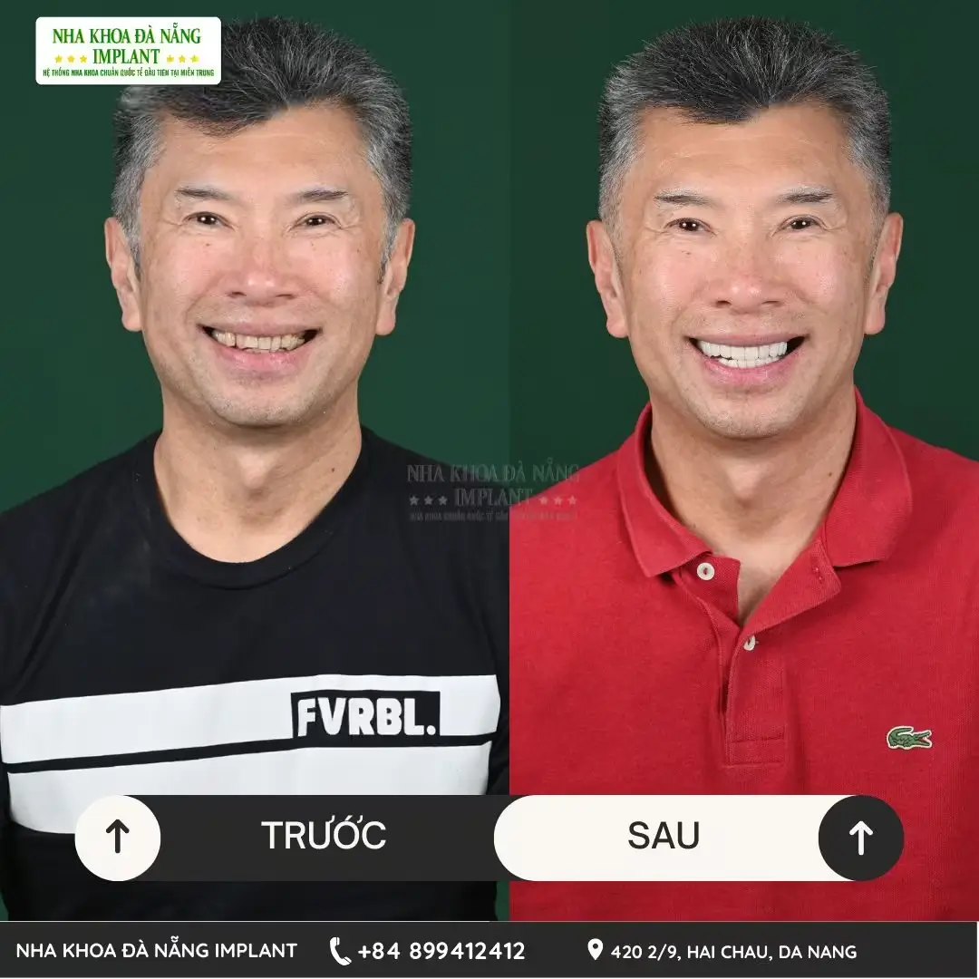 Khách hàng Nguyễn Timothy