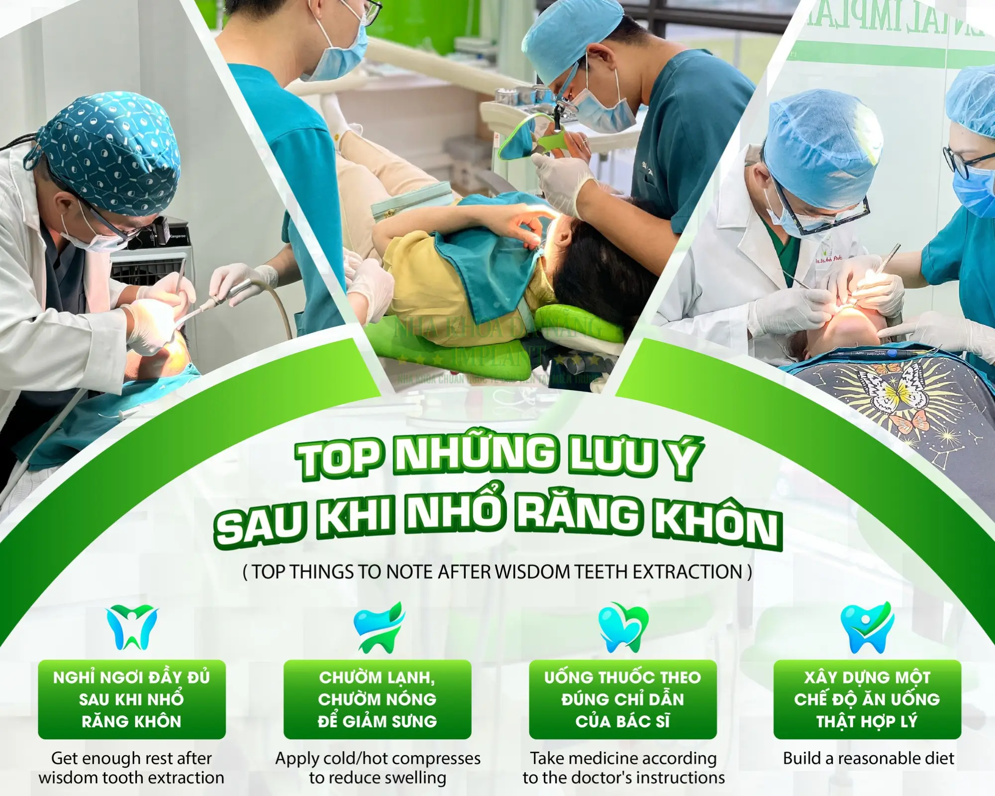 Những lưu ý sau khi nhổ răng khôn