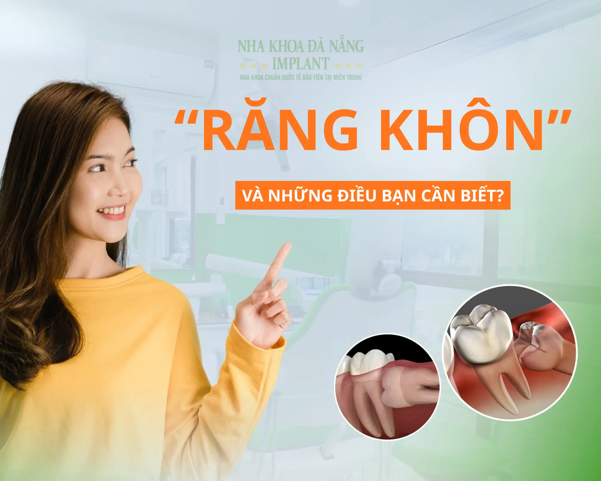 Răng Khôn: Nên Nhổ Hay Không? Khi Nào Cần Gặp Bác Sĩ Ngay?