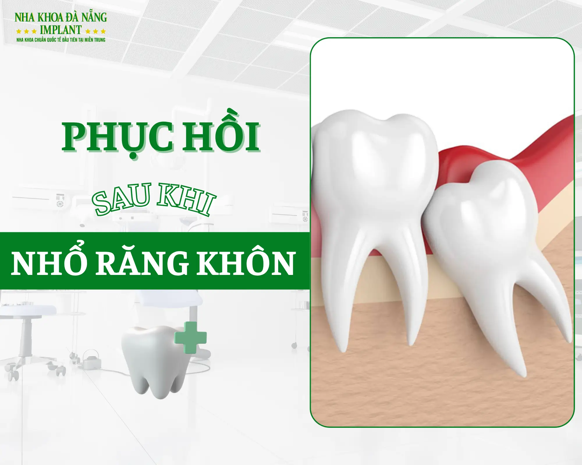 Điều gì xảy ra sau khi nhổ răng khôn – Hồi phục nhanh nhờ mẹo nhỏ này